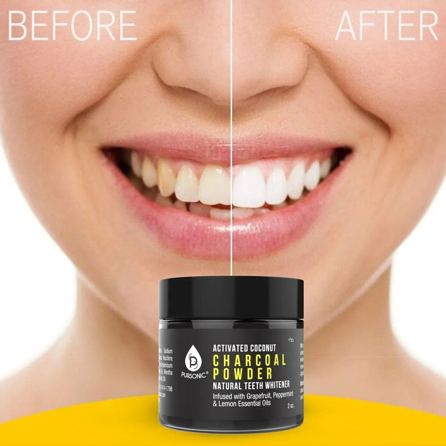 Activated Coconut Charcoal Powder Natural Teeth Whitener - Gifts for You 'n Me