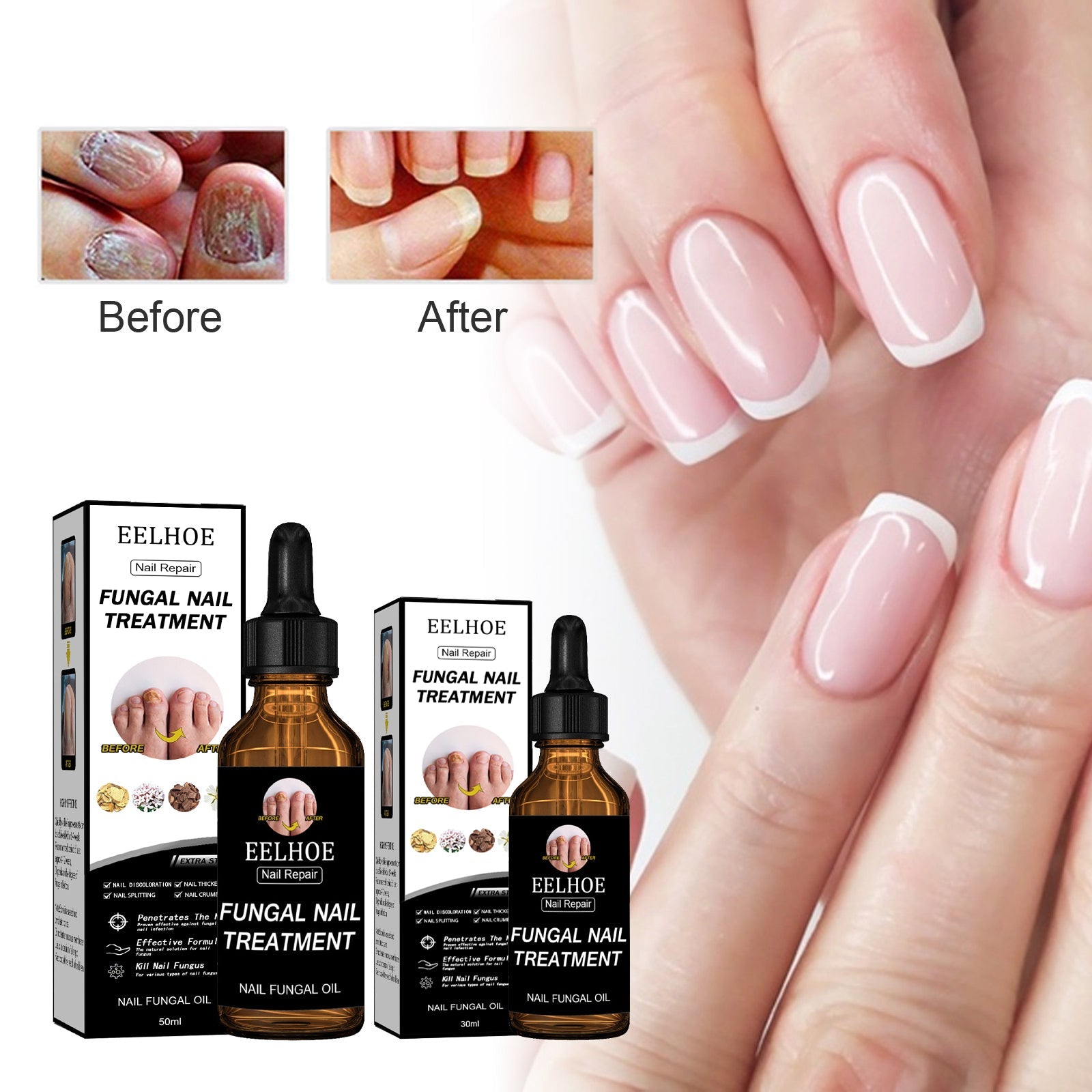 Nail Repair Solution Thickening And Brightening Nails Removing Gray Nail Repair Nourishing Nail Care Solution
