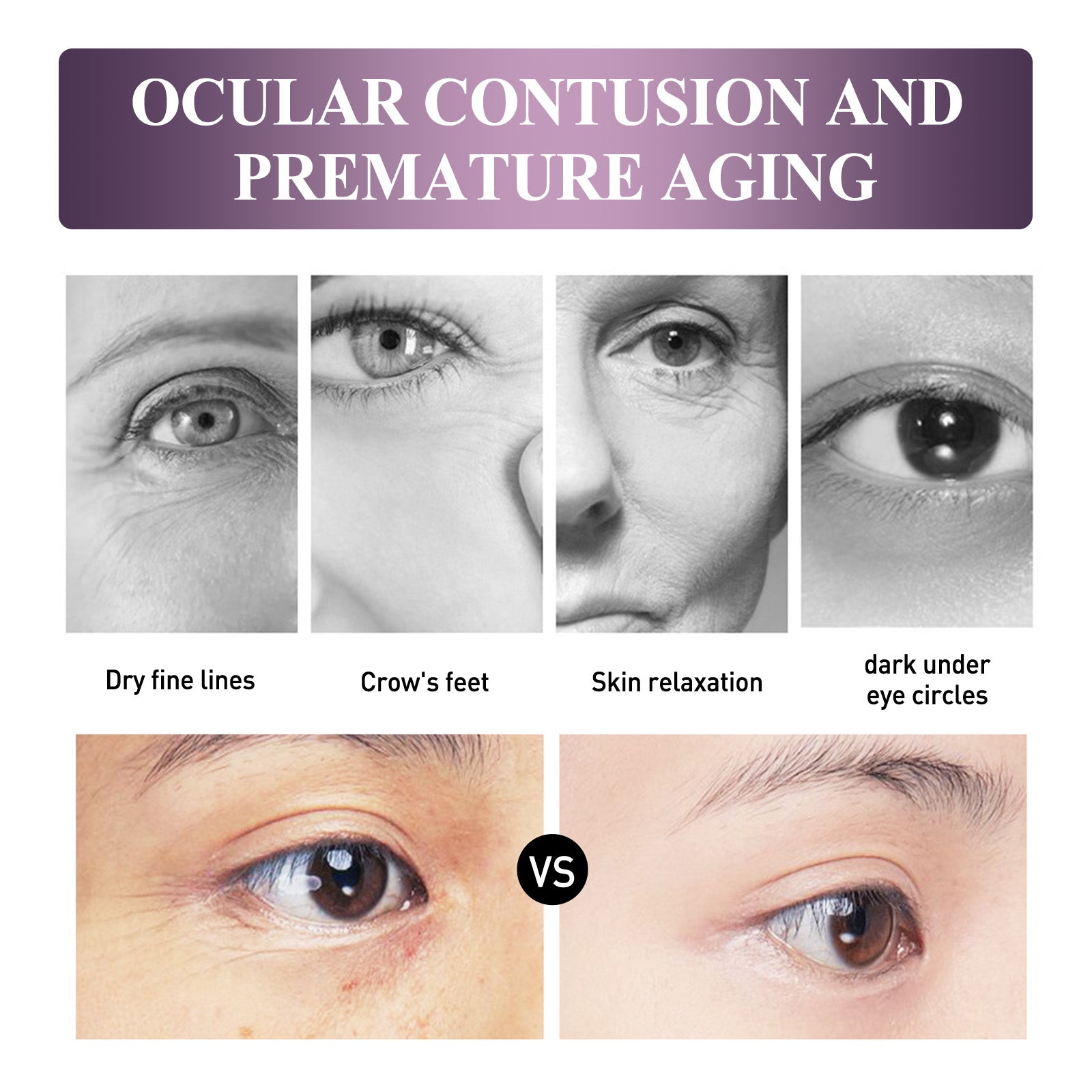 Electric Anti-Wrinkle Eye Cream Lifts, Strengthens, Moisturizes And Reduces Fine Lines, Bags And Dark Circles Under Eye Care