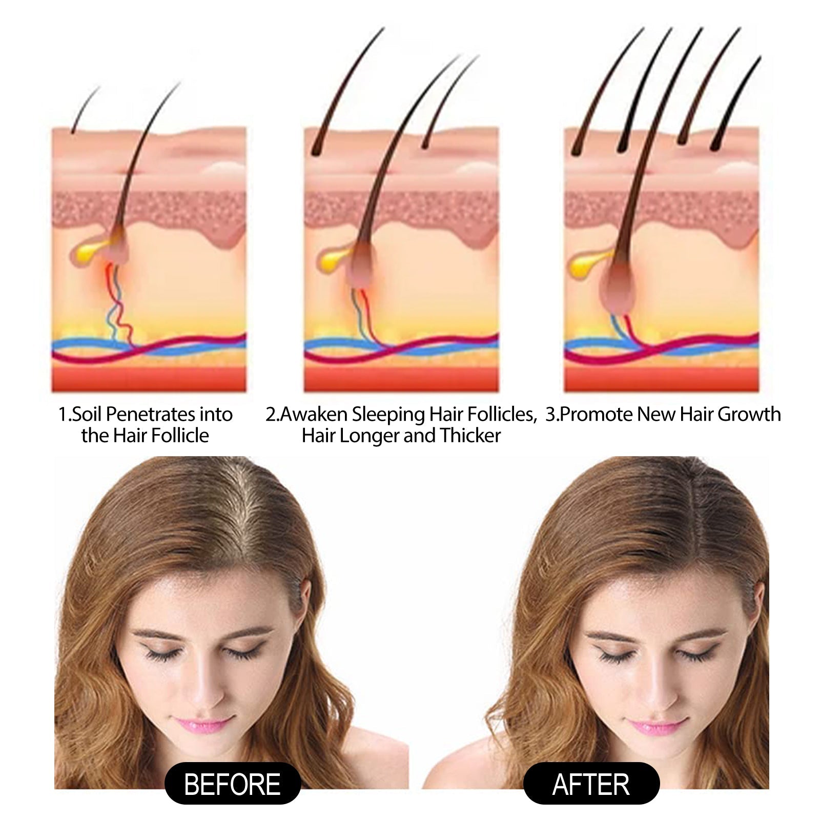 Hair Essence, Repair Dry Hair, Moisturize Hair Roots And Scalp Hair Essence