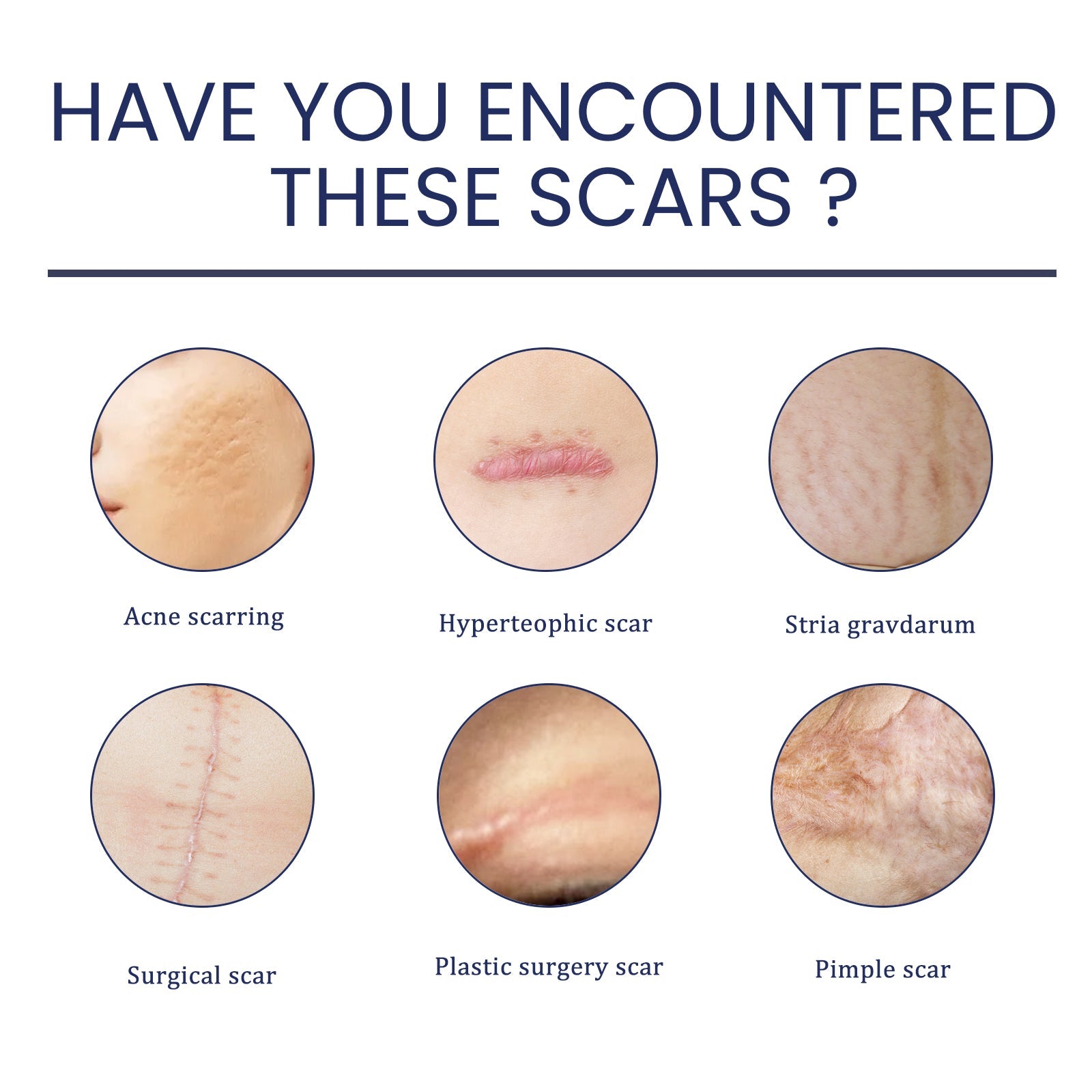 Scar Gel, Fade Skin Scar Pregnancy Surgery Scar Moisturizing Skin Care Gel