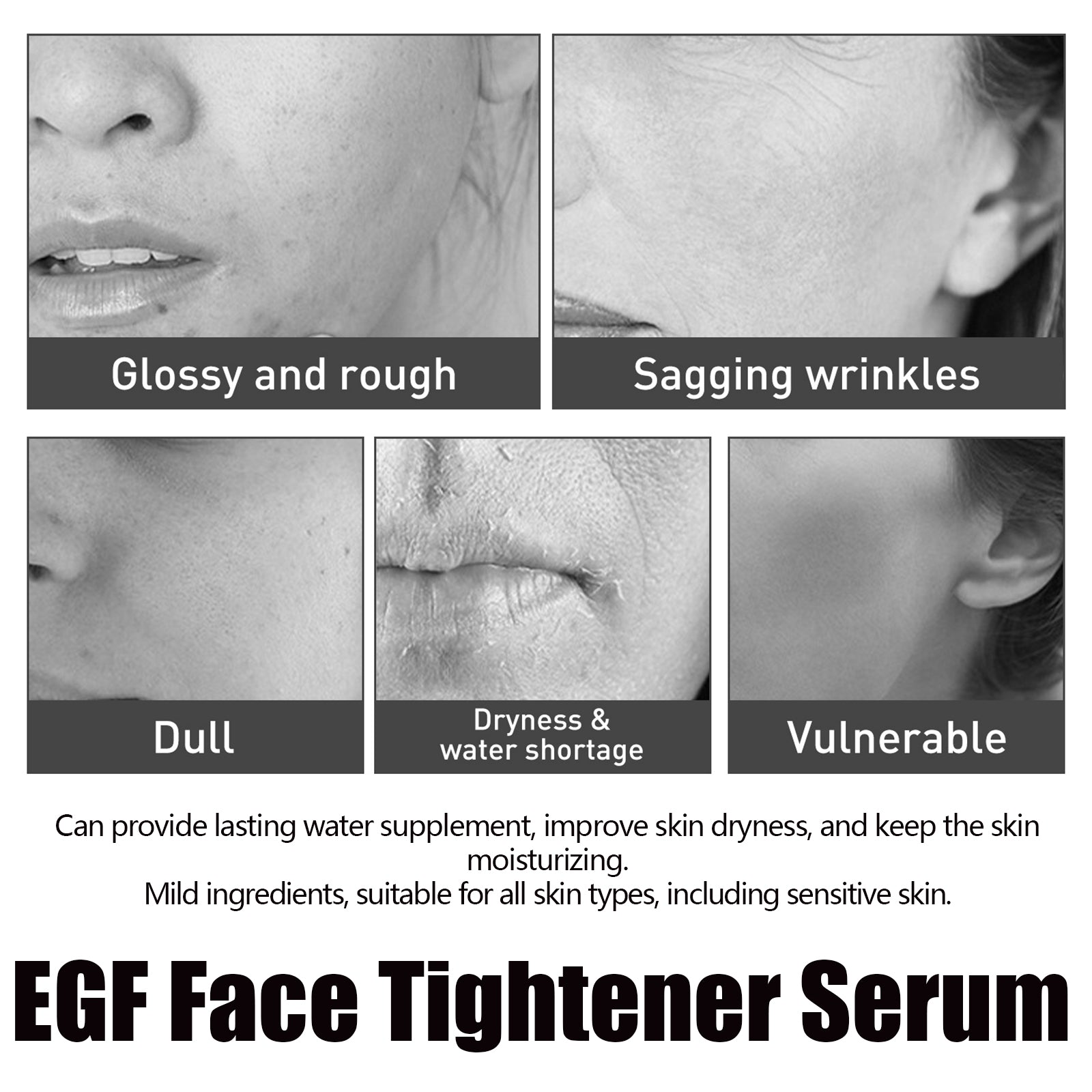 Egf Face Tightener Serum, Lighten Fine Lines Deep Hydrating Firming And Moisturizing Facial Essence