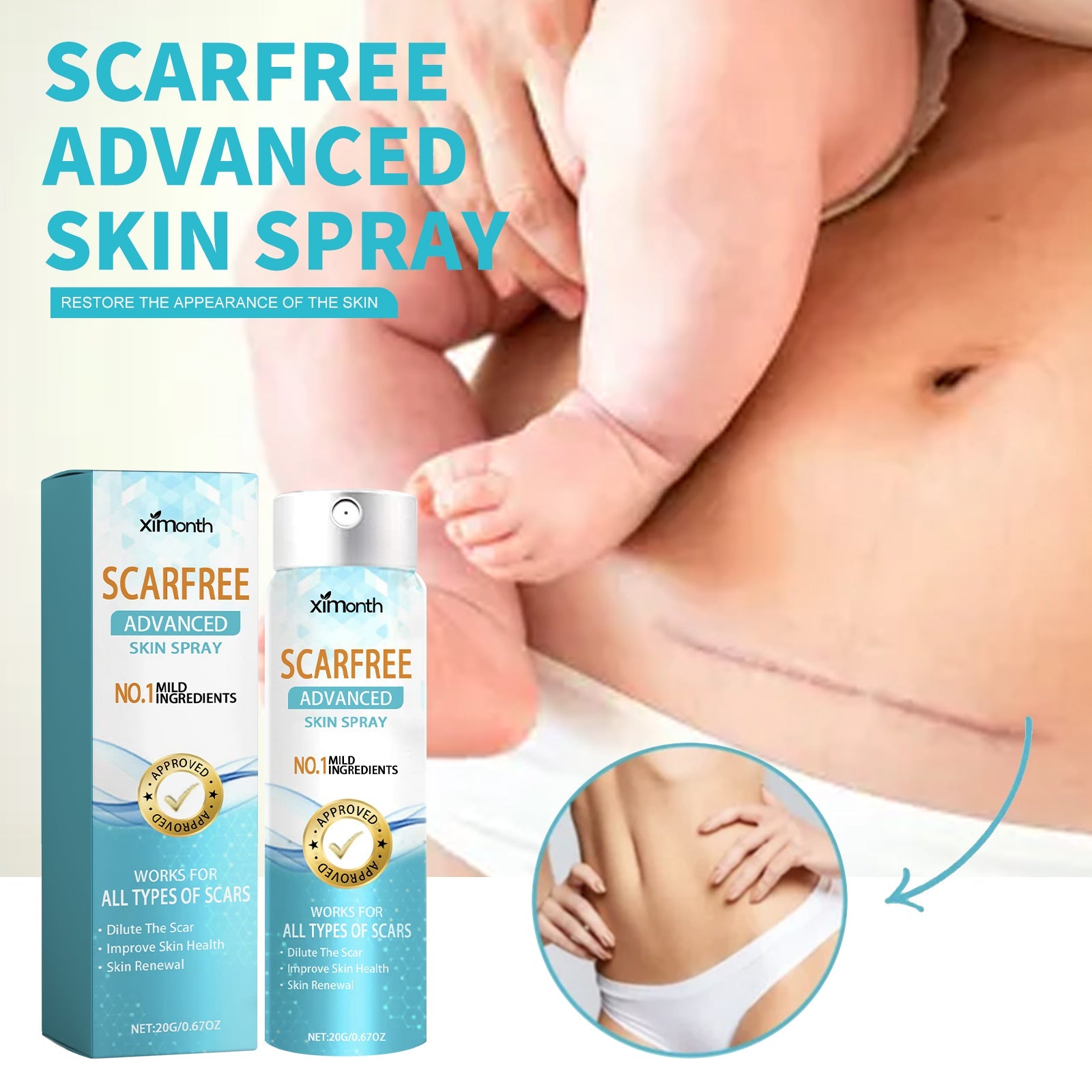 Scarfree Advanced Skin Spray, Body Skin Care Reduces Post-Natal Scars And Smooths Skin