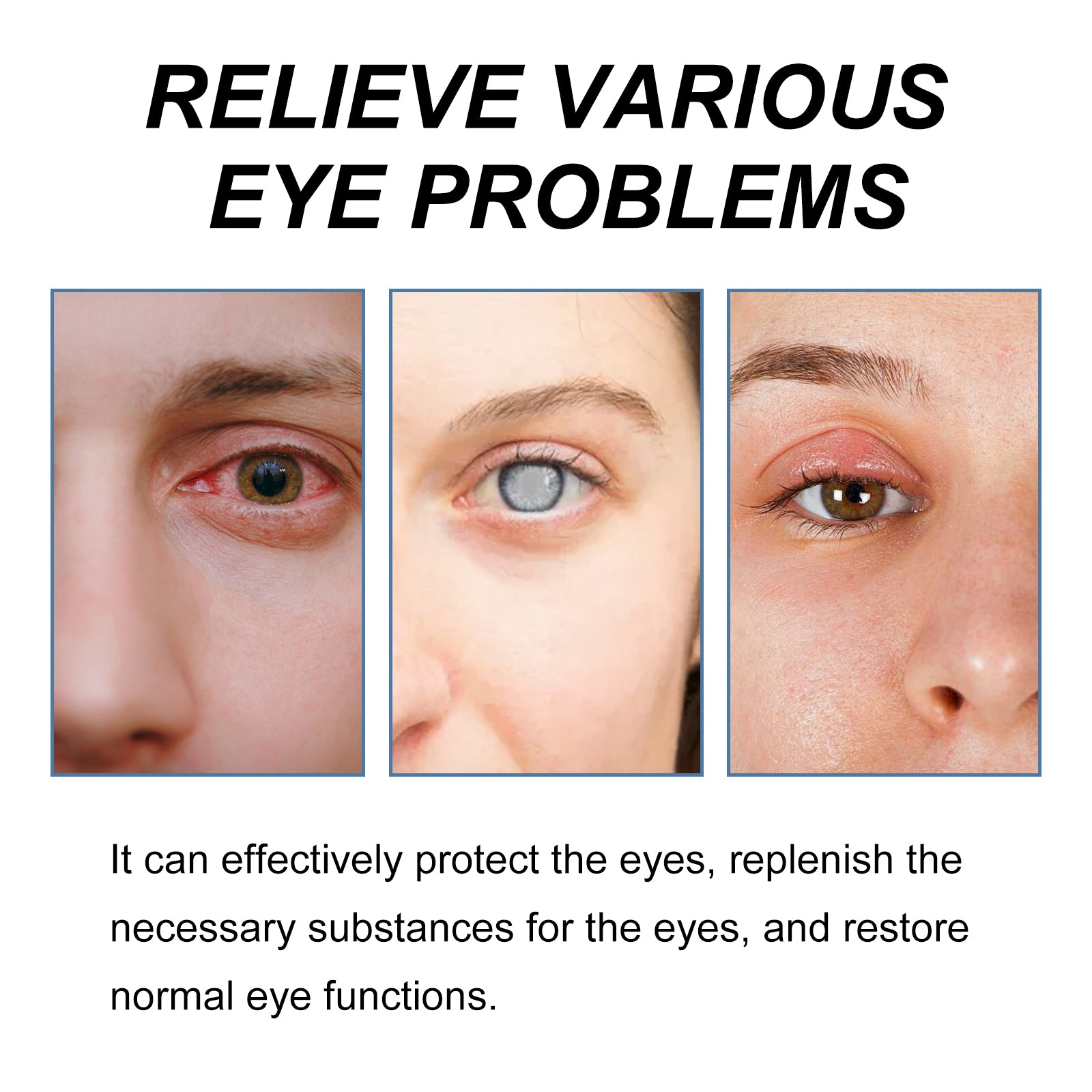 Myopia Reversal Eye Drops, Relieve Eye Discomfort Repair Eye Fatigue And Dry Eye Moisturizing Lotion