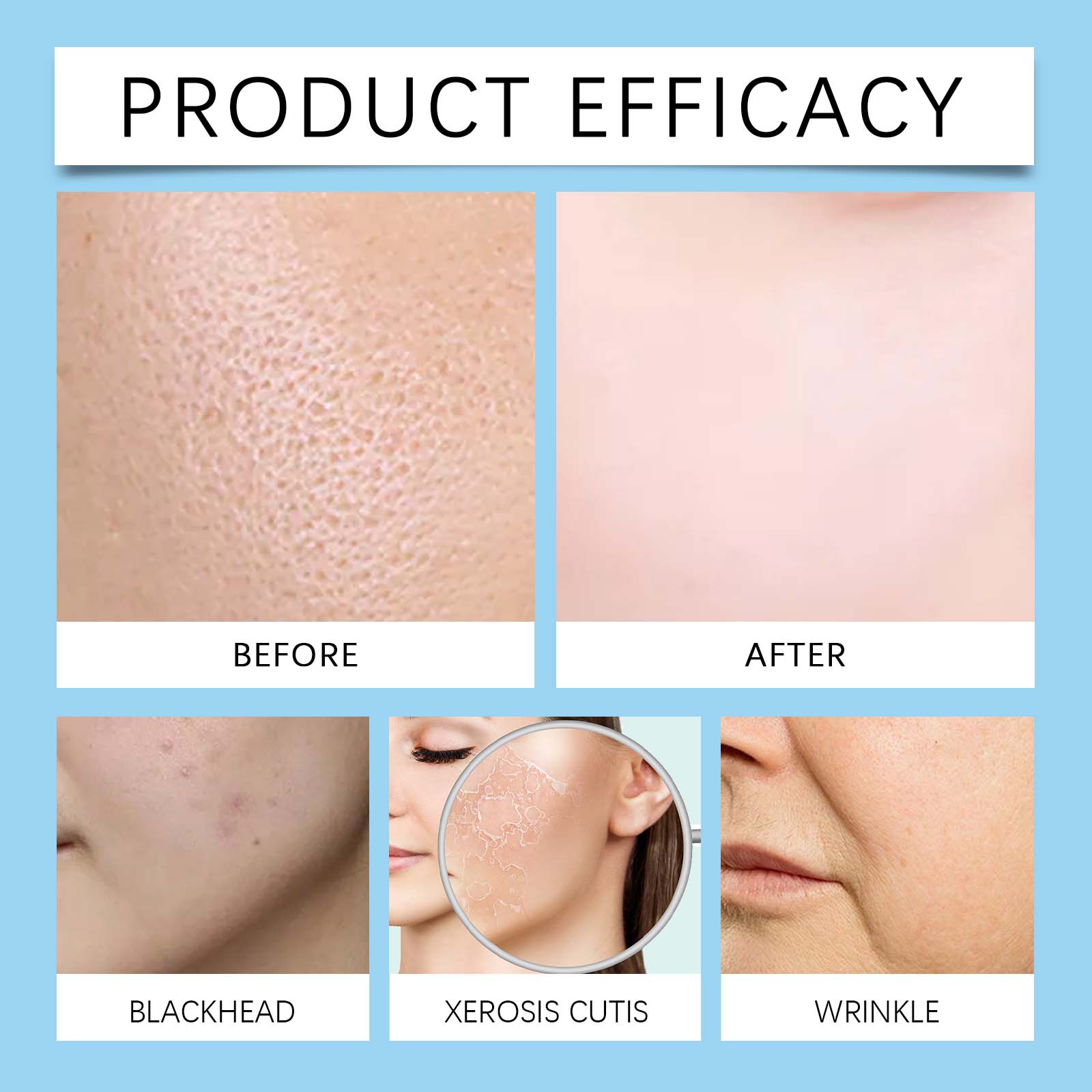 Hyaluronic Acid Face Serum, Facial Gentle Nourishing And Moisturizing Improve Skin Texture