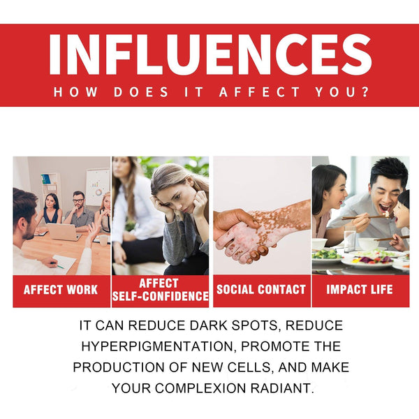 Dark Spot Whitening Cream, Lightening Yellow Brown White Spot Cream Dark Spots Correct Skin Tone Moisturize Skin Whitening