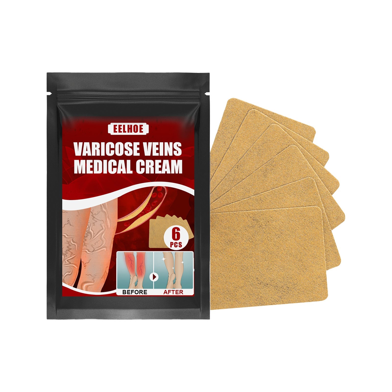 Aricose Veins Medical Cream, Relieve Leg Swelling Earthworm Leg Vein Massage To Relieve Pain