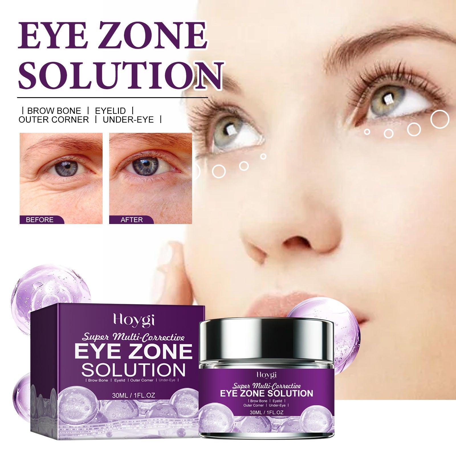 Eye Zone Solution, Niacinamide Moisturizing And Firming Eye Anti-Aging Eye Cream