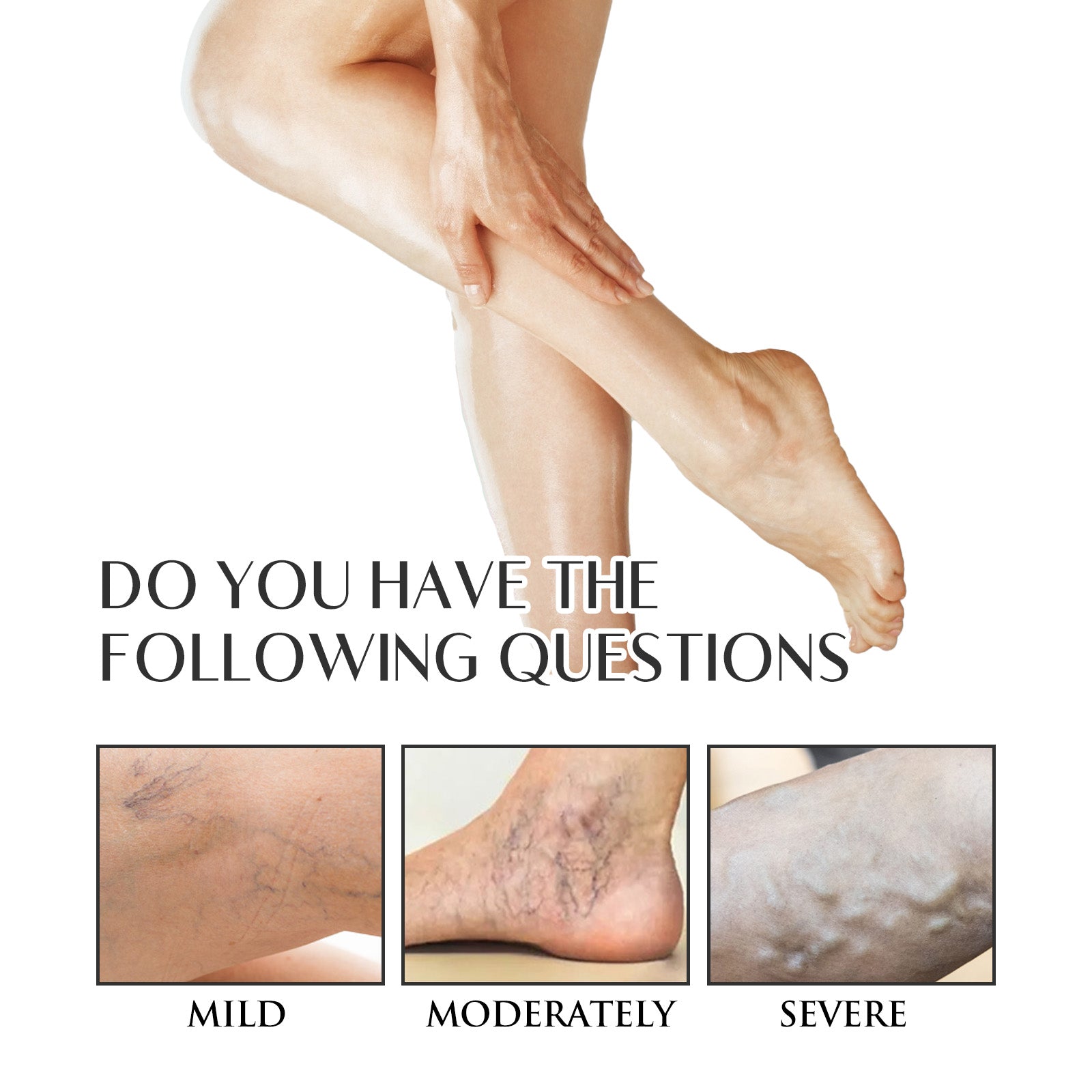 Varicose Veins Soothing Spray, Relief Of Sore Leg Muscles Massage Repair Earthworm Leg Vein Treatment Spray