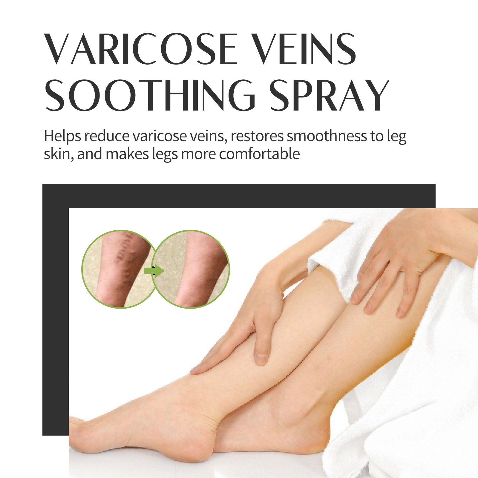 Varicose Veins Soothing Spray, Relief Of Sore Leg Muscles Massage Repair Earthworm Leg Vein Treatment Spray