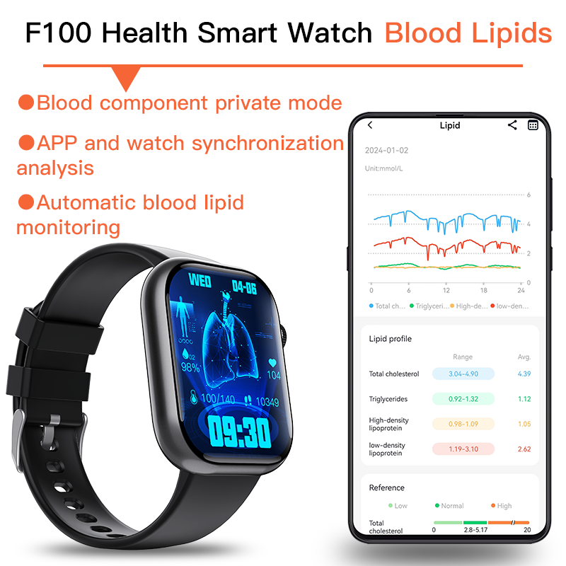 Best ECG Smart Watch of 2024 With Blood Pressure Monitor+Blood Glucose Monitoring