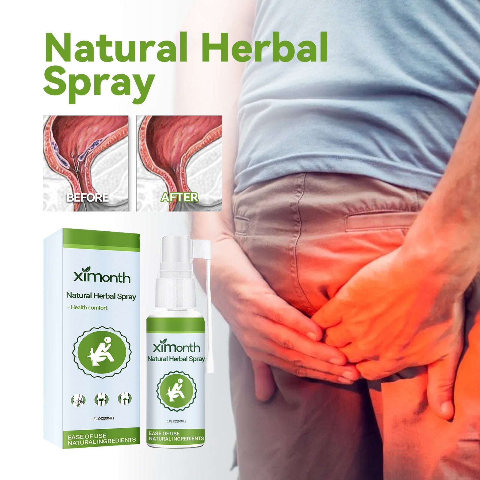 Natural Herbal Hemorrhoid Spray, Soothing Perianal Itchiness And Soothing Anal Care Spray