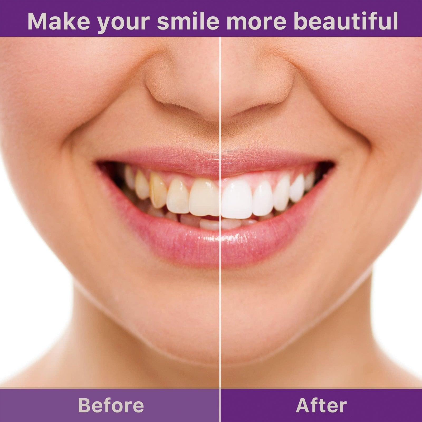 Tooth Cleaning Mousse, Anti-Decay Clean Teeth Tartar Breath Fresh Whitening Teeth Toothpaste