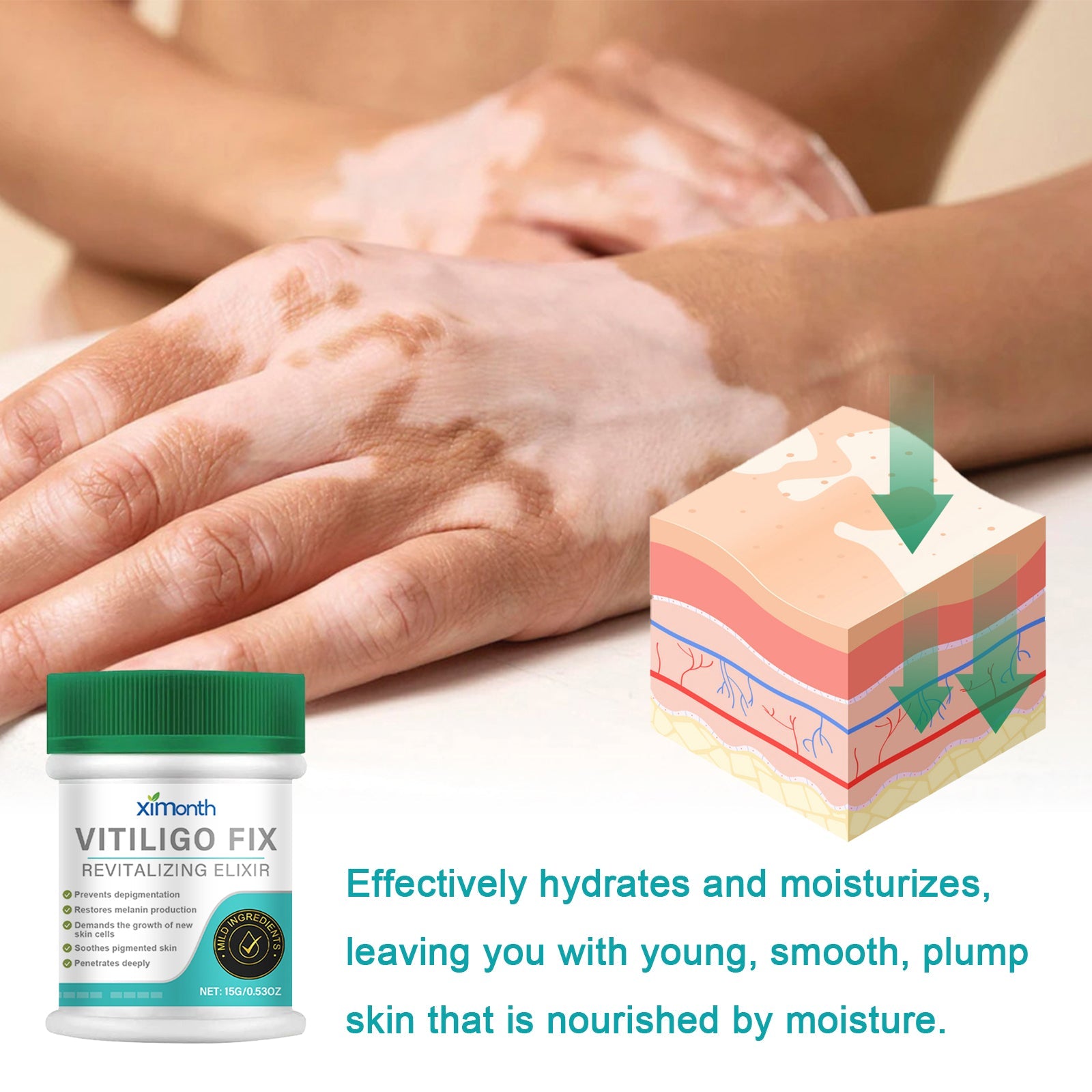 Vitiligo Fix Revitalizing Elixir, Lighten Skin Spots Even Skin Tone Moisturizing Body Care Repair Cream