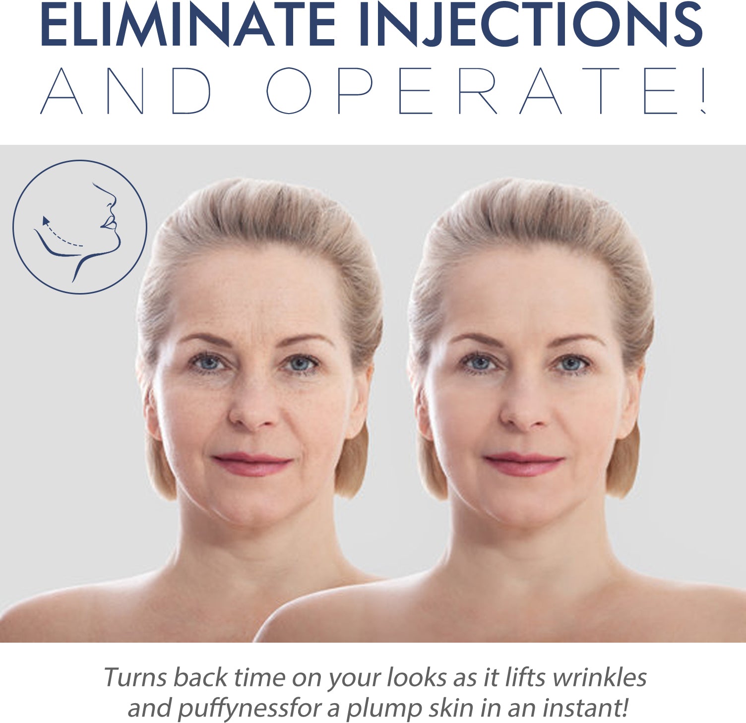 Face Lift Firming And Lifting Face Relaxers With Fine Lines Anti-Wrinkle Face Lift