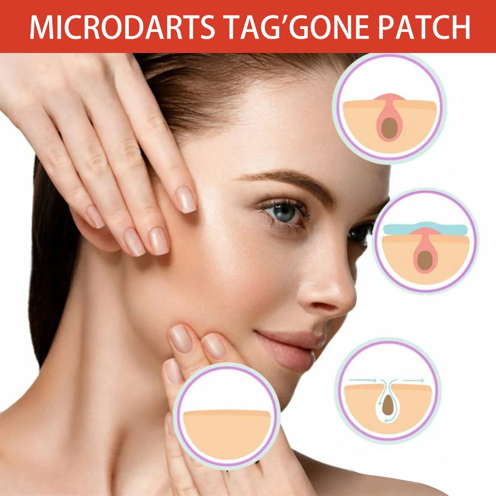 Acne Patch, Skin Clean Acne Pimple Moles Gram Wart Corns Spot Patch