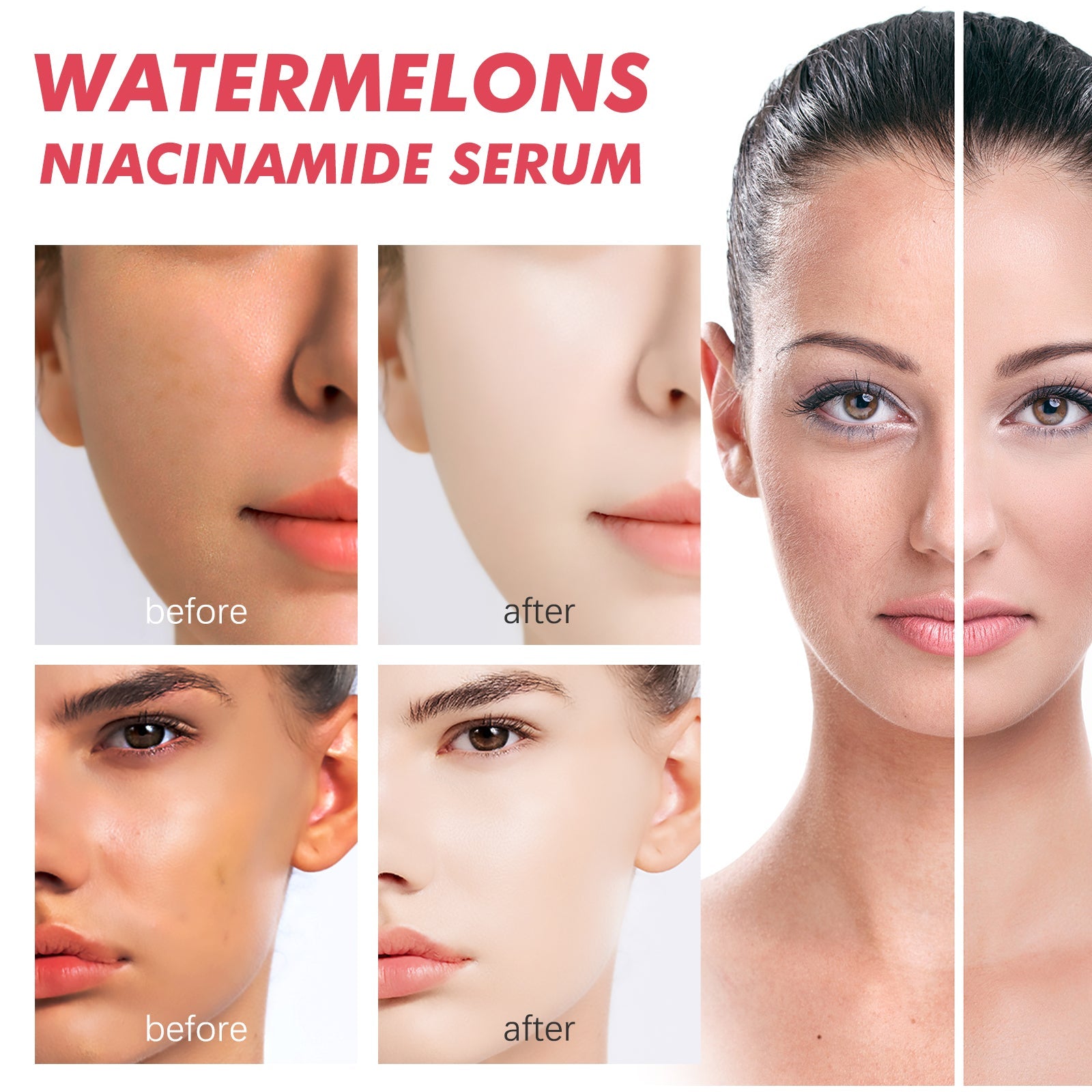Watermelons Niacinamide Serum, Dilute Spots Firming Haun White Skin Hydrating Moisture Essence