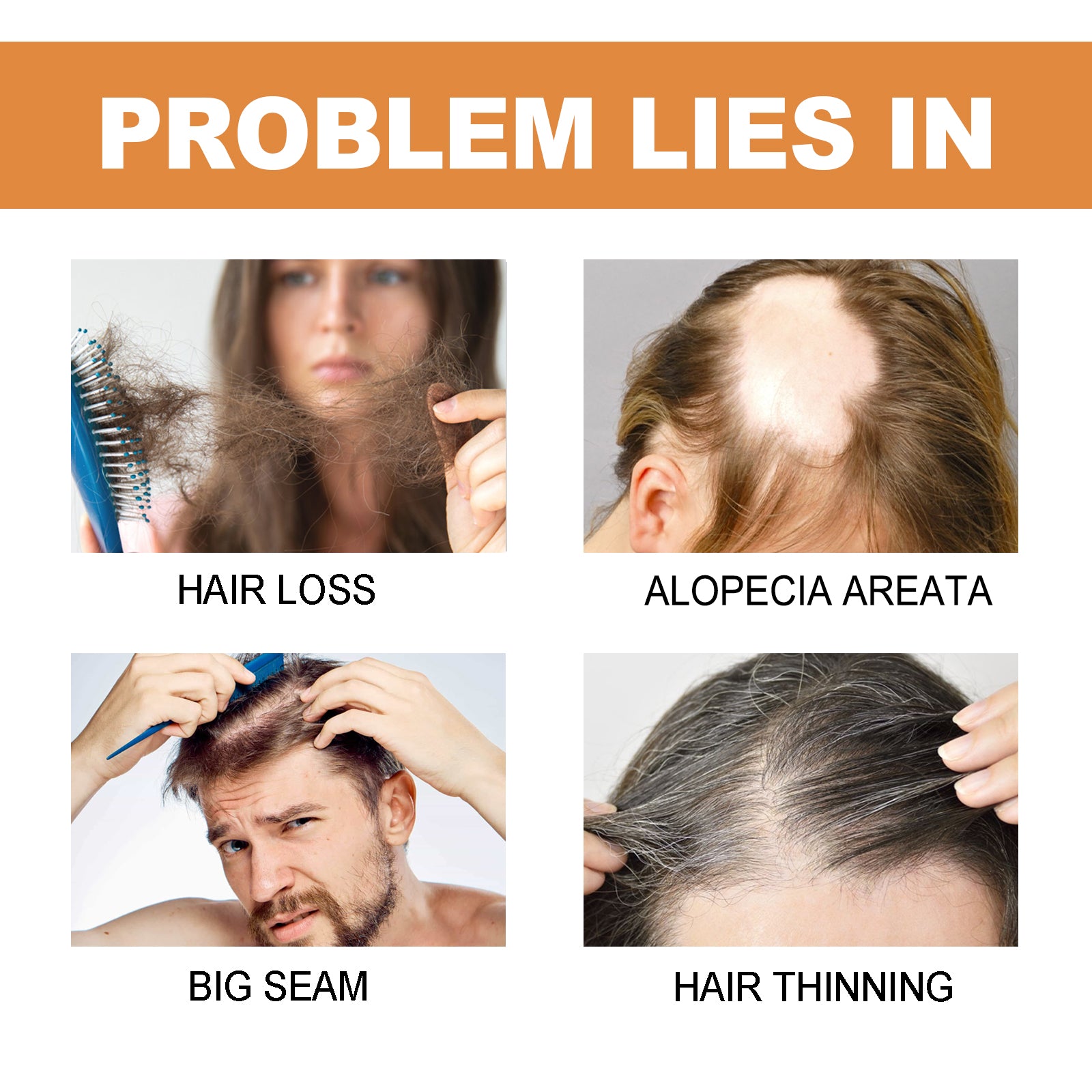 Mypa Ampoule, Strengthen And Repair Hair, Prevent Hair Loss, Strengthen Hair Root And Thicken Hair And Scalp Massage Solution