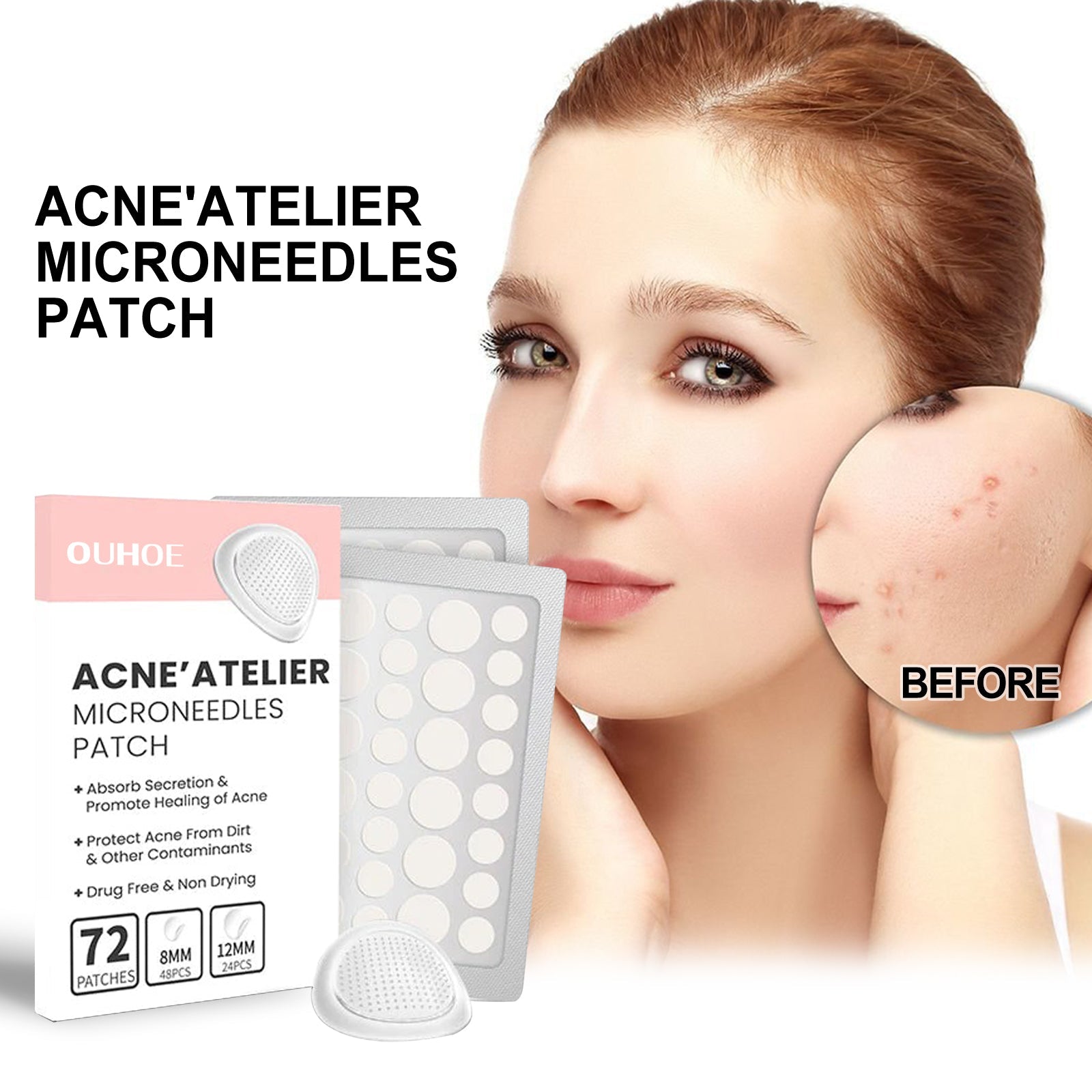 Acne Patch, Repair Acne Pimple Facial Redness Clean Pores Moisturize Skin Patch