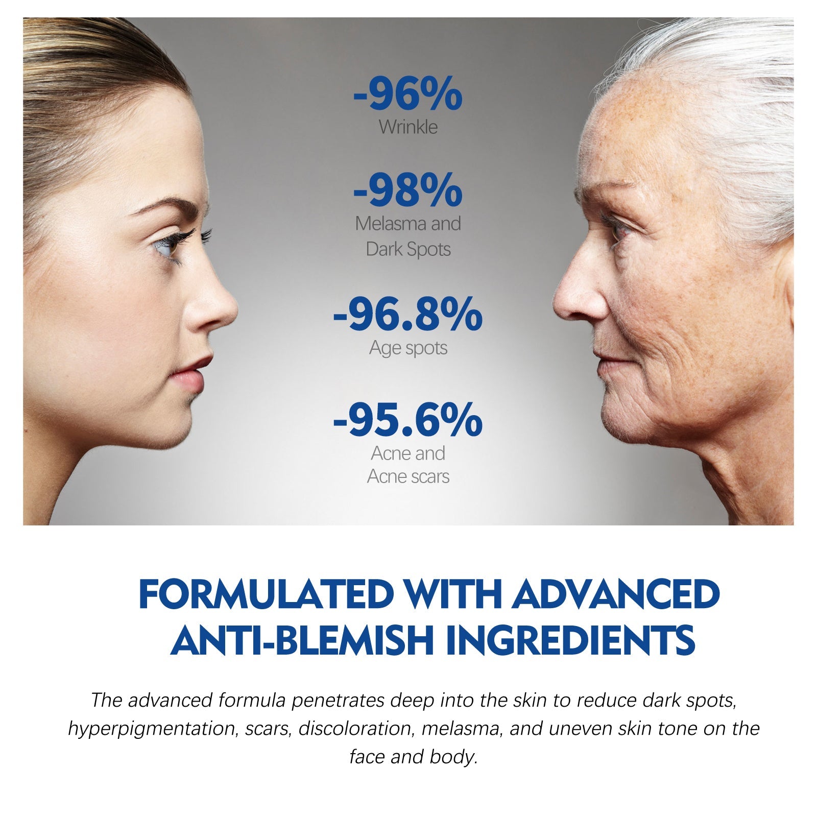 Dark Spot Repair Essence, Repair Acne Pimple Lightening Spot Fine Lines Moisturizing Firming Whitening Essence