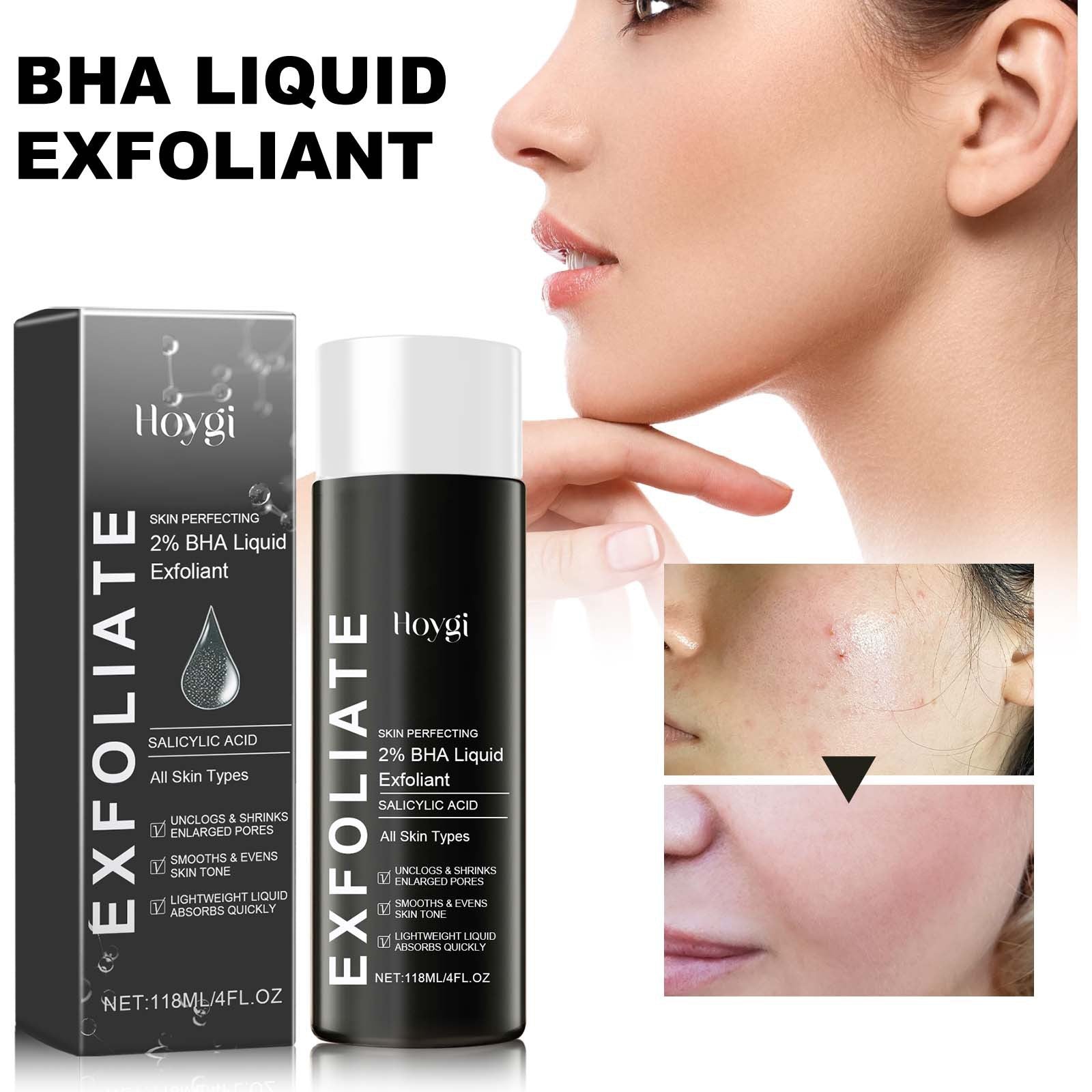 BHA Liquid Exfoliant, Lightening Acne Seal Pore-Tightening And Moisturizing Skin Essence