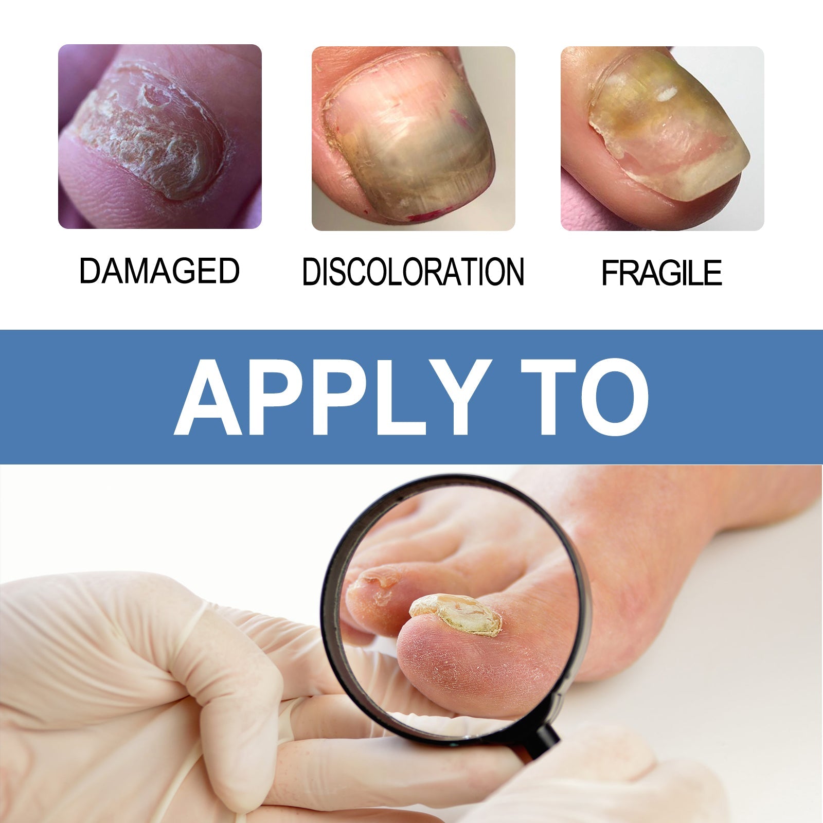 Nail Care Gel, Hand And Foot Gray Nails Soft Nail Shine Nail Thickening Nail Repair Gel