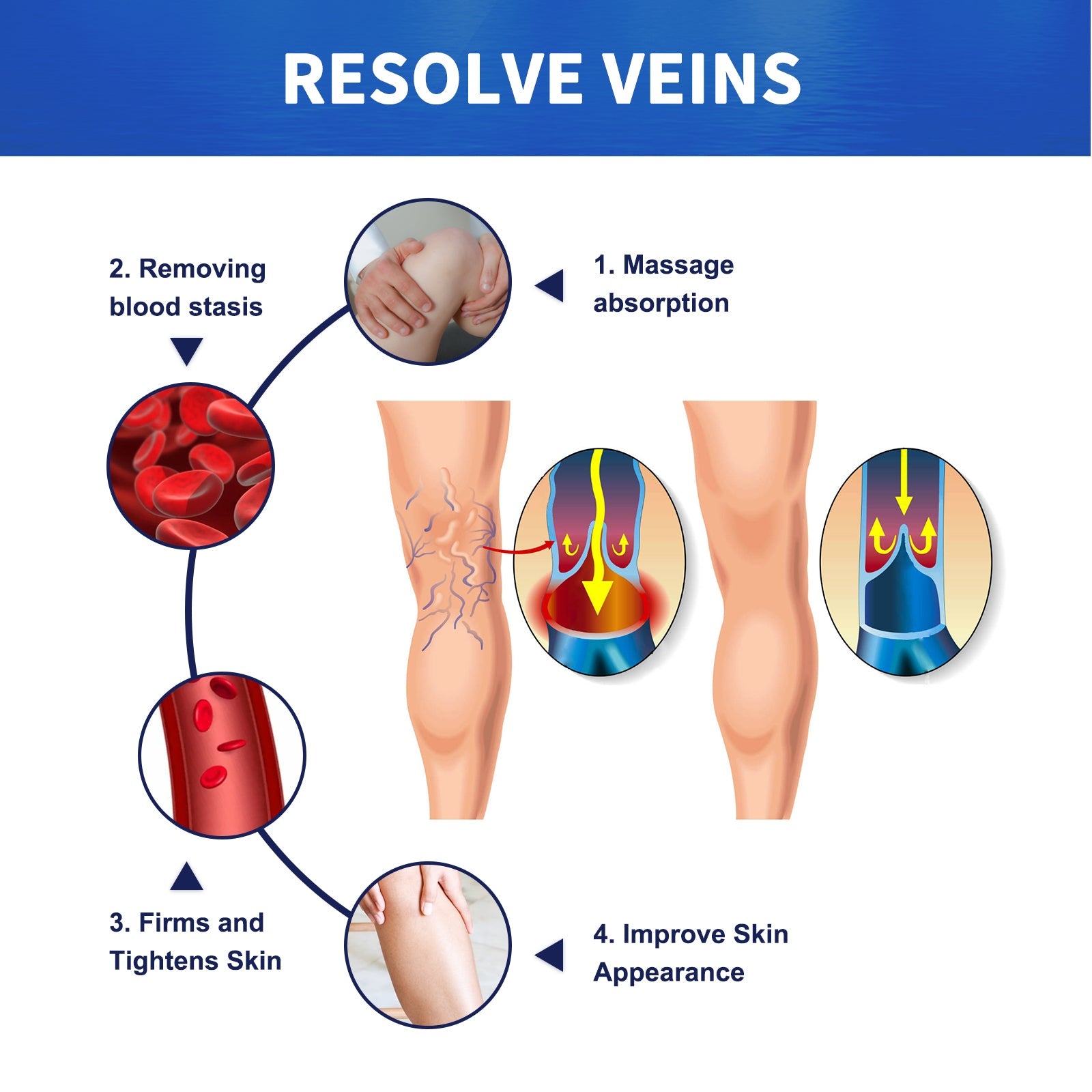 Vein Massage Varicose Cream Repair Earthworm Legs To Relieve Leg Blood Vessel Bulge And Varicoidea