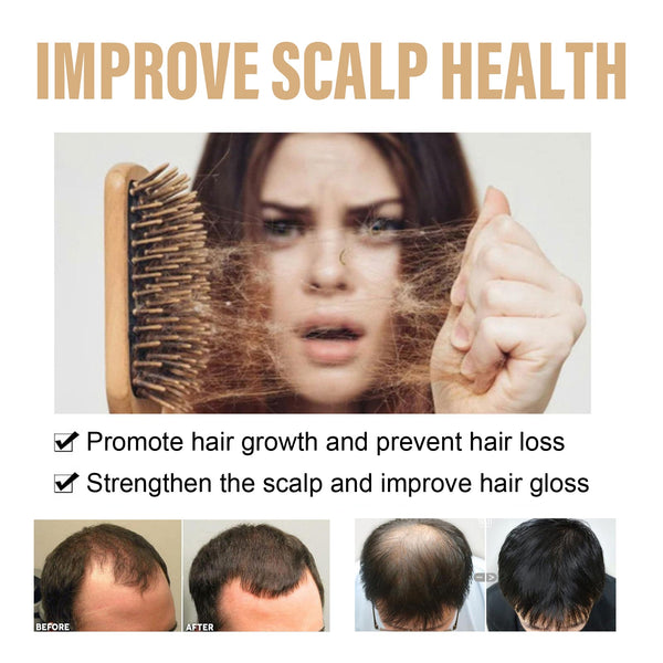 Shampoo Scalp Cleansing Care Fluffy Strong Hair Moisturizing Soft Light Smooth Hair Shampoo