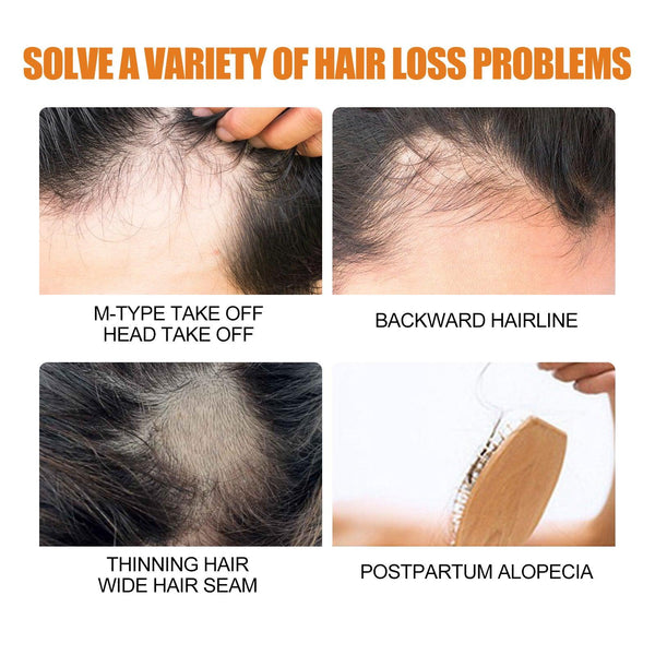 Hair Growth Spray, Men Hair And Beard Thickening Strengthening Anti-loss Care Solution