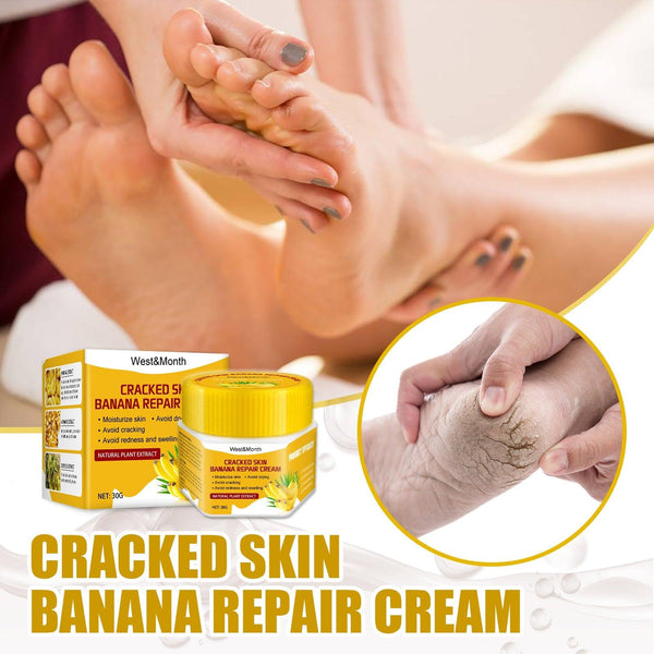 Cracked Skin Banana Repair Cream, Nourishing And Moisturizing Foot Repair Cream To Soften Exfoliation And Remove Dead Skin Calluses