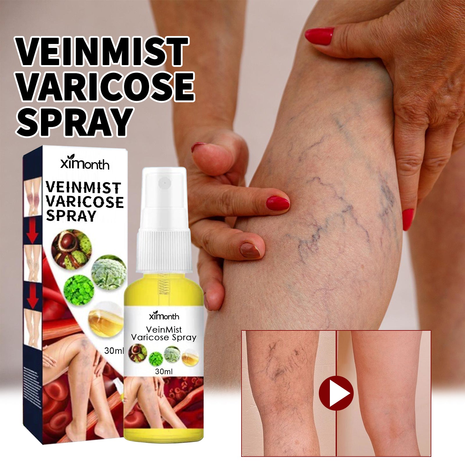 Veinmist Varicose Spray, Relief Sore Legs Massage Earthworm Leg Vein Treatment Spray