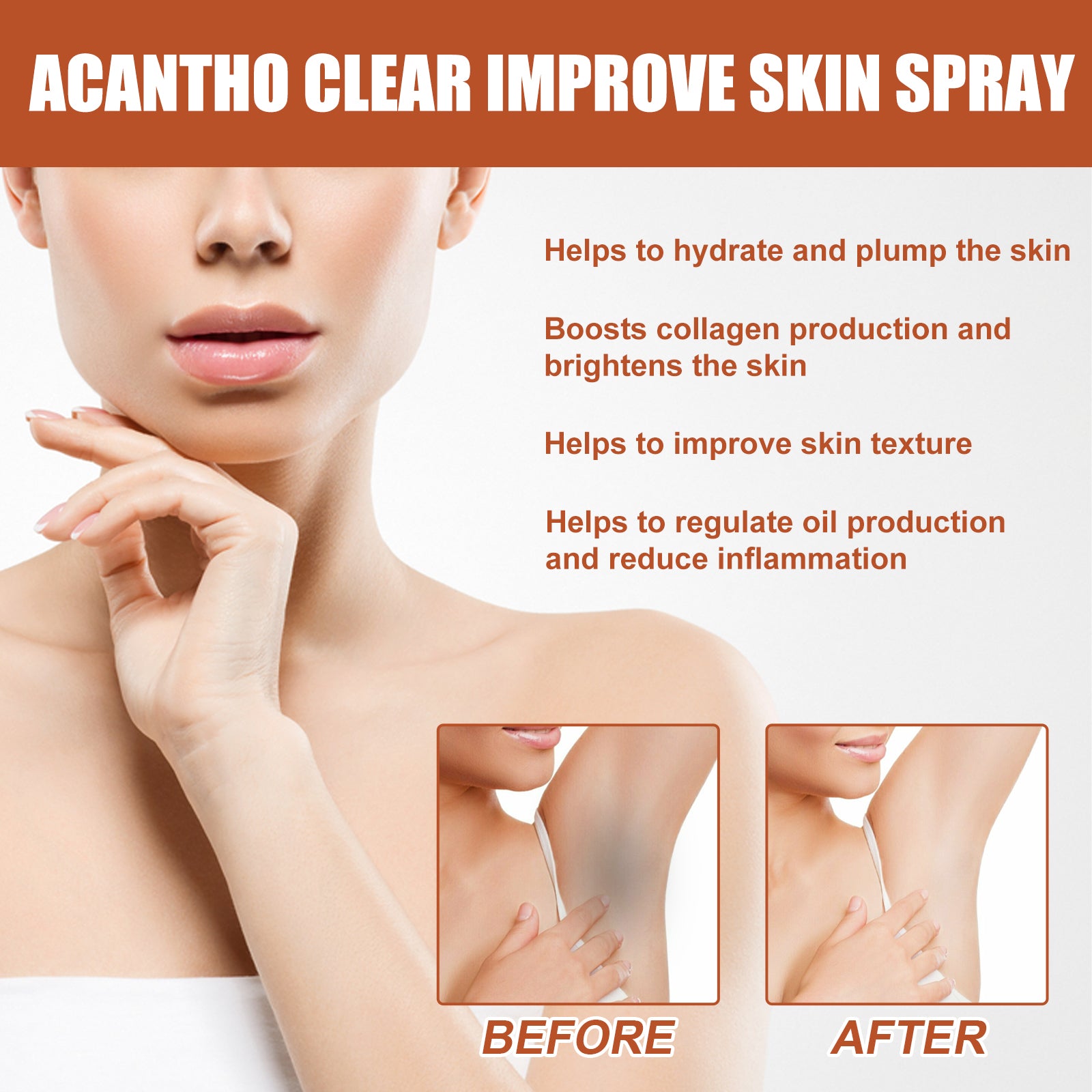 Acantho Clear Improve Skin Spray, Repair Black Spot, Elbow Knee Joint Black Whitening Skin Spray
