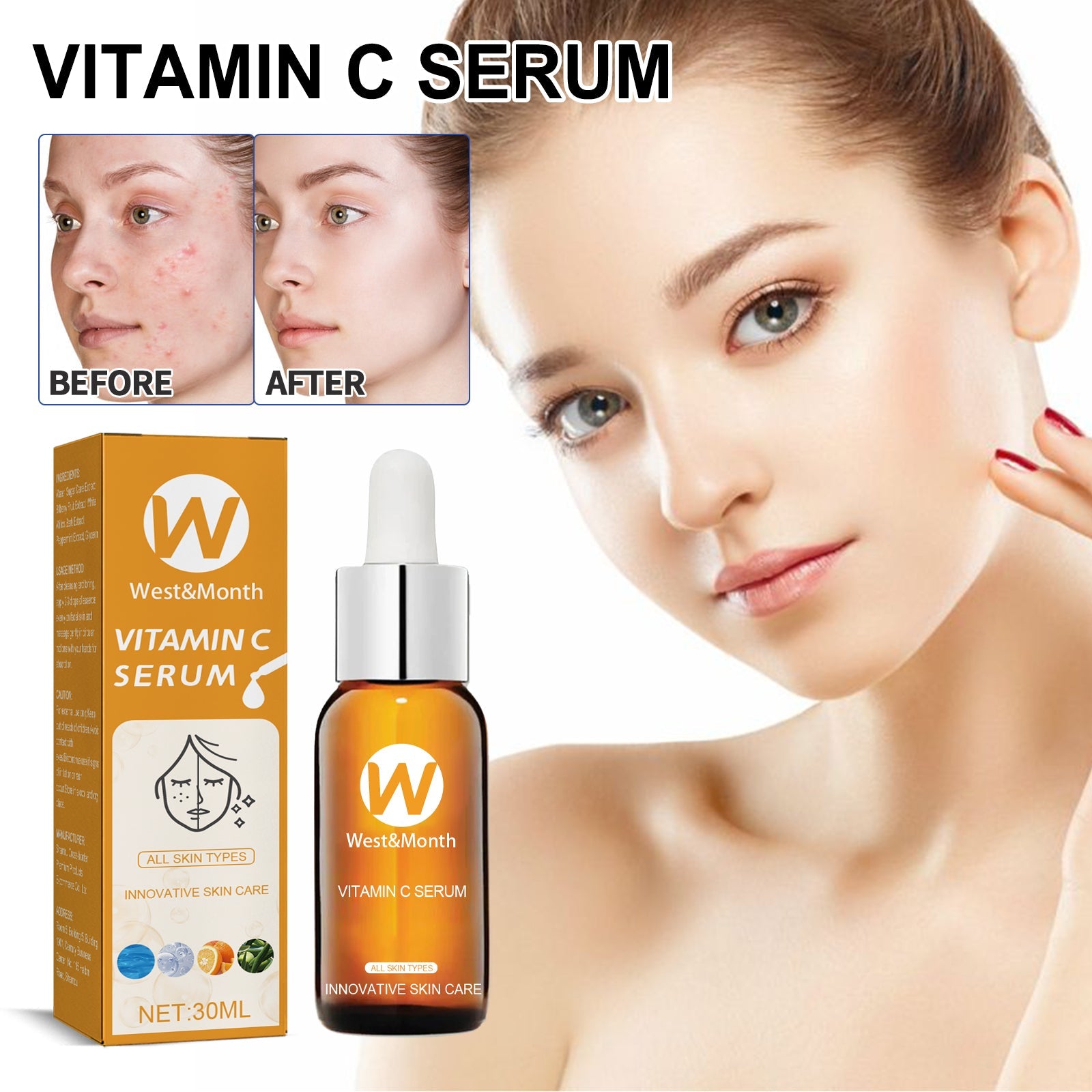 Facial Treatment Essence, Lighten Facial Acne Mark Oil Control Firming Skin Essence