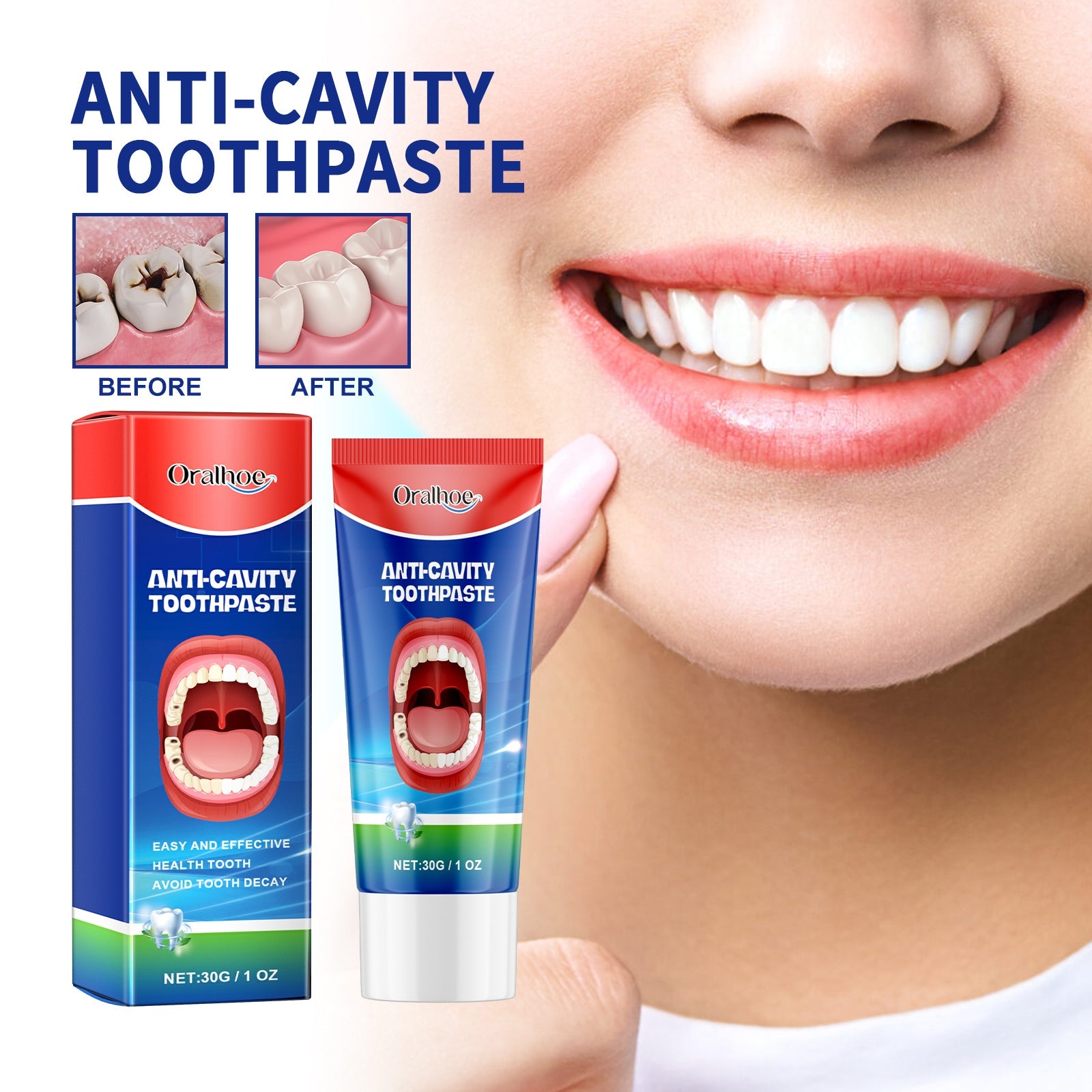 Anti-Cavity Toothpaste, Oral Cleaning Dental Yellow Caries Dental Care Gingival Reinforcement Dental Care Fresh Breath