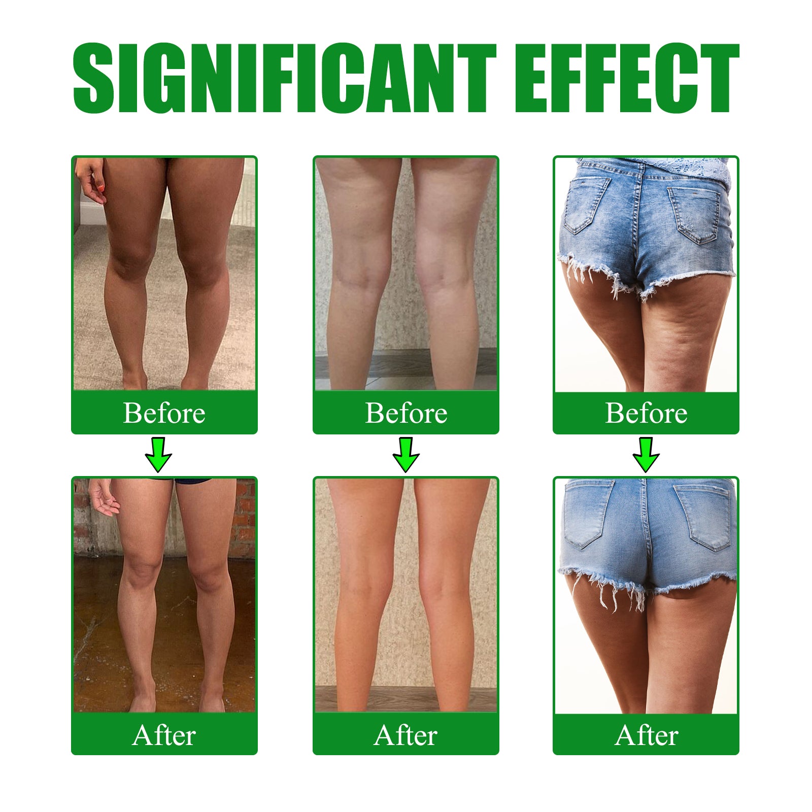 Moxa Leg Lift Paste, Tight Leg Fat, Anti-Orange Peel Shape Lazy People To Create Beautiful Slim Legs
