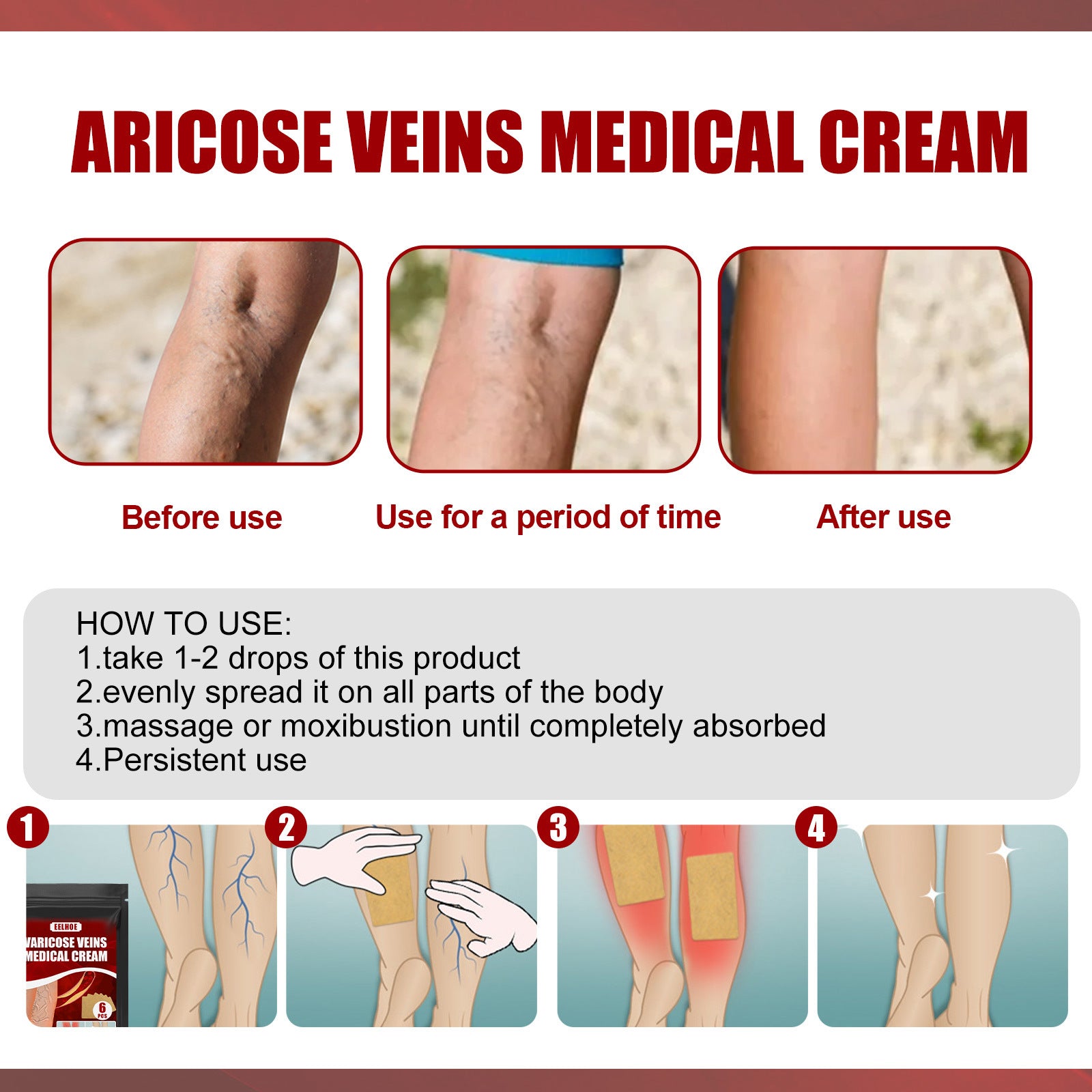 Aricose Veins Medical Cream, Relieve Leg Swelling Earthworm Leg Vein Massage To Relieve Pain