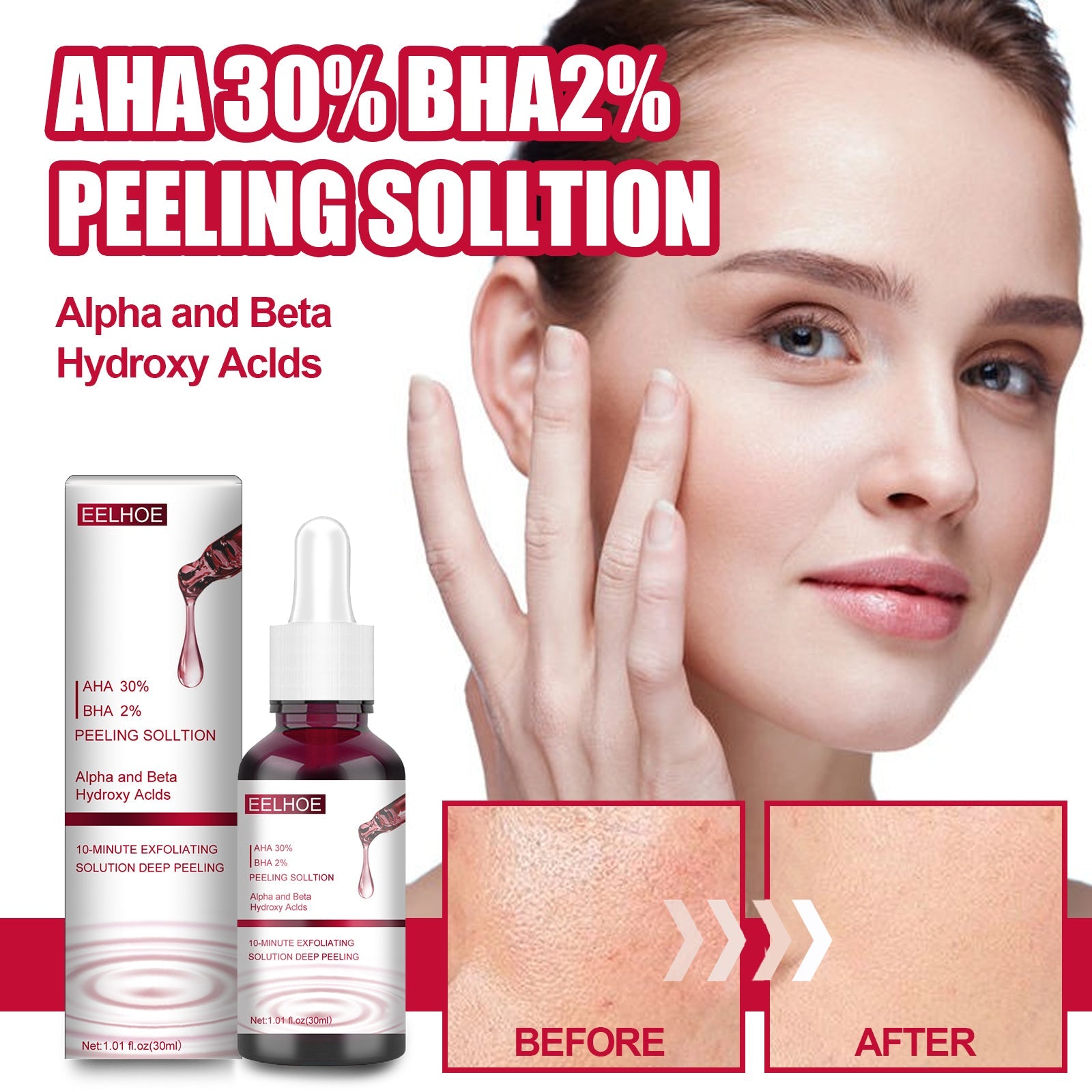 AHA30% + BHA 2% Fruit Acid Salicylic Acid Essence, Exfoliating Cleaning Blackheads Acne And Shrinking Pores Essence