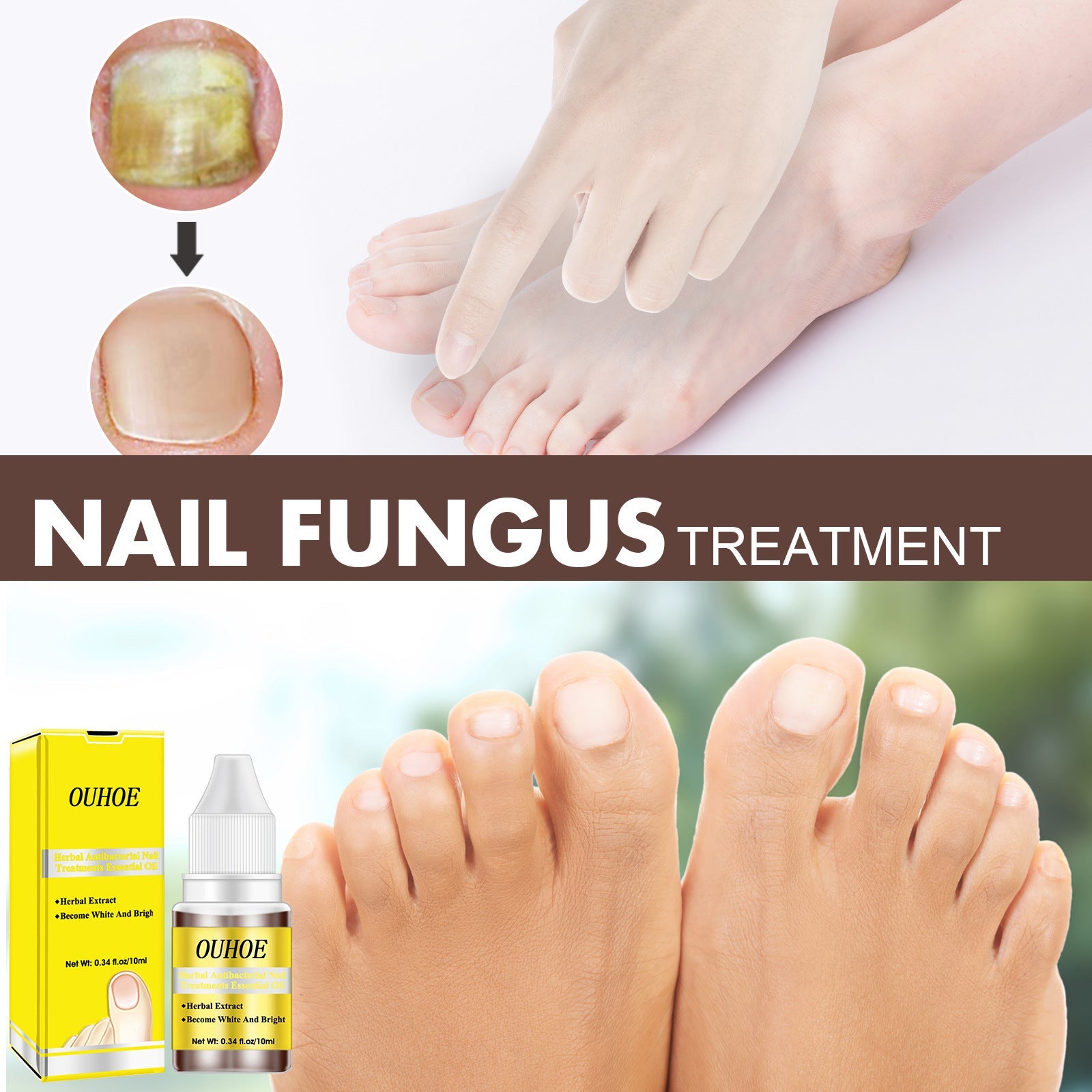 Herbal Antibacterial Nail Treatments Essential Oil, Grey Nail Care Essential Oil Brightening Nail Polish Clean Manicure Foot Care Solution