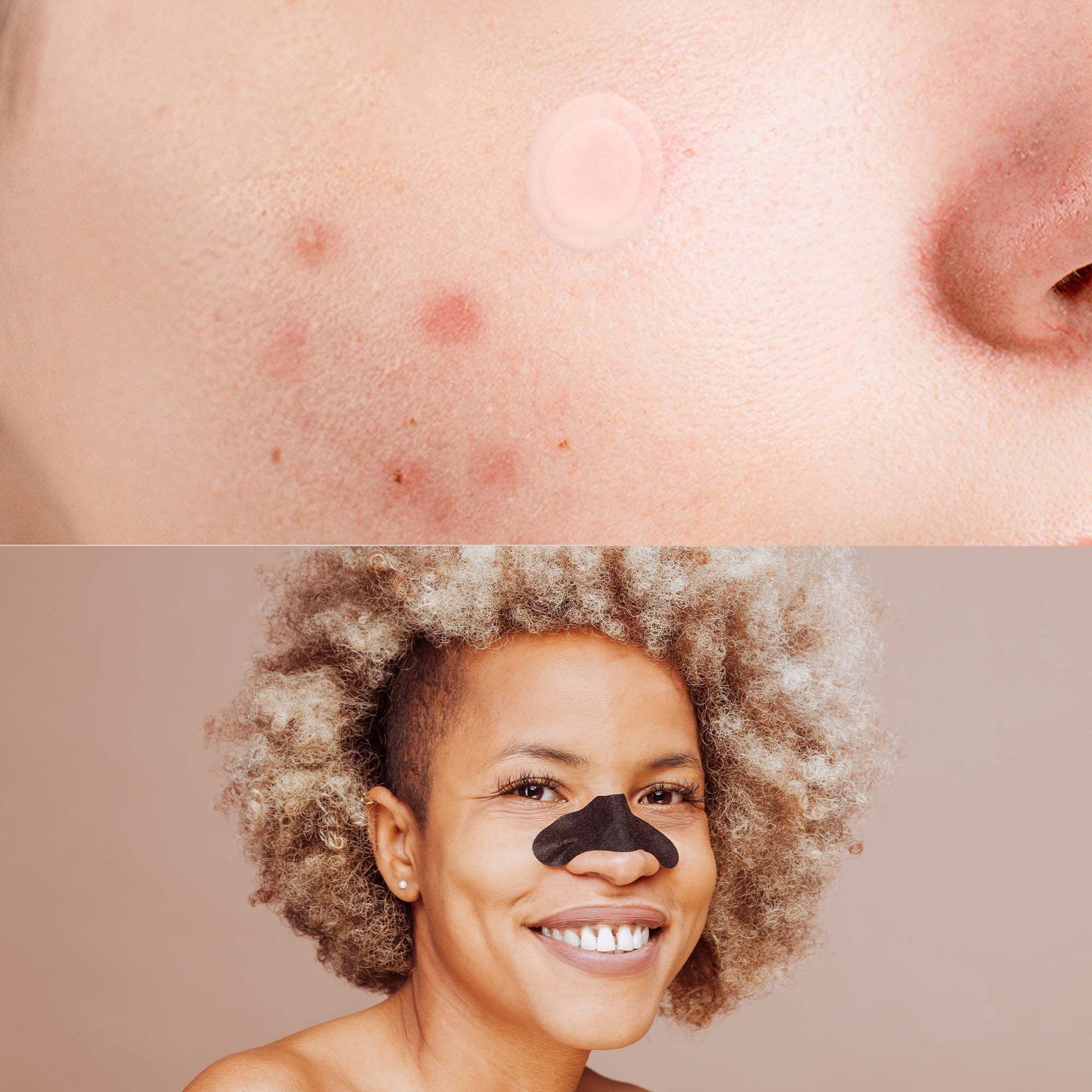 Pursonic Deep Cleansing Charcoal Nose Pore Strip 6-Pack & Hydrocolloid Pimple Patch, 120-Count