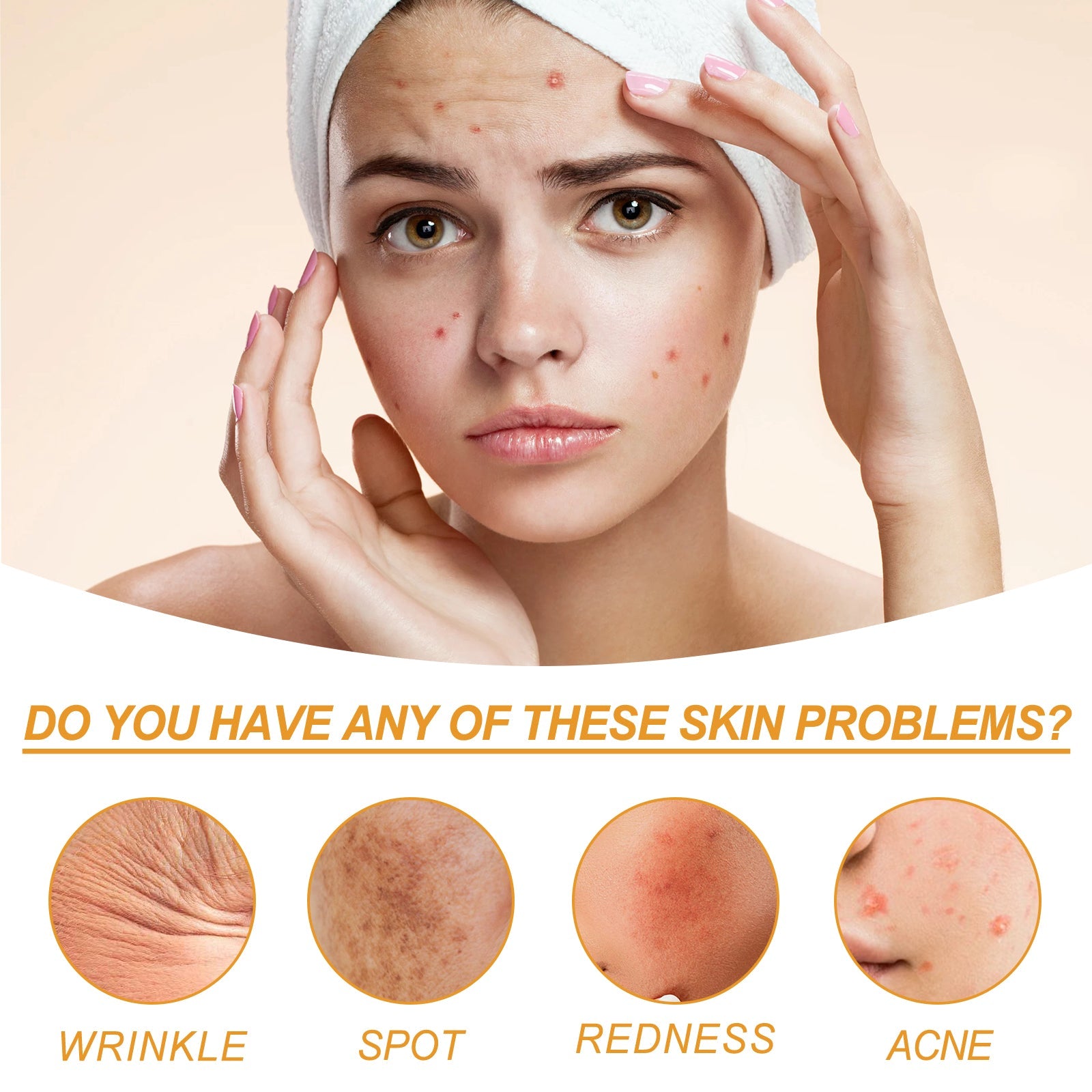 Facial Treatment Essence, Lighten Facial Acne Mark Oil Control Firming Skin Essence