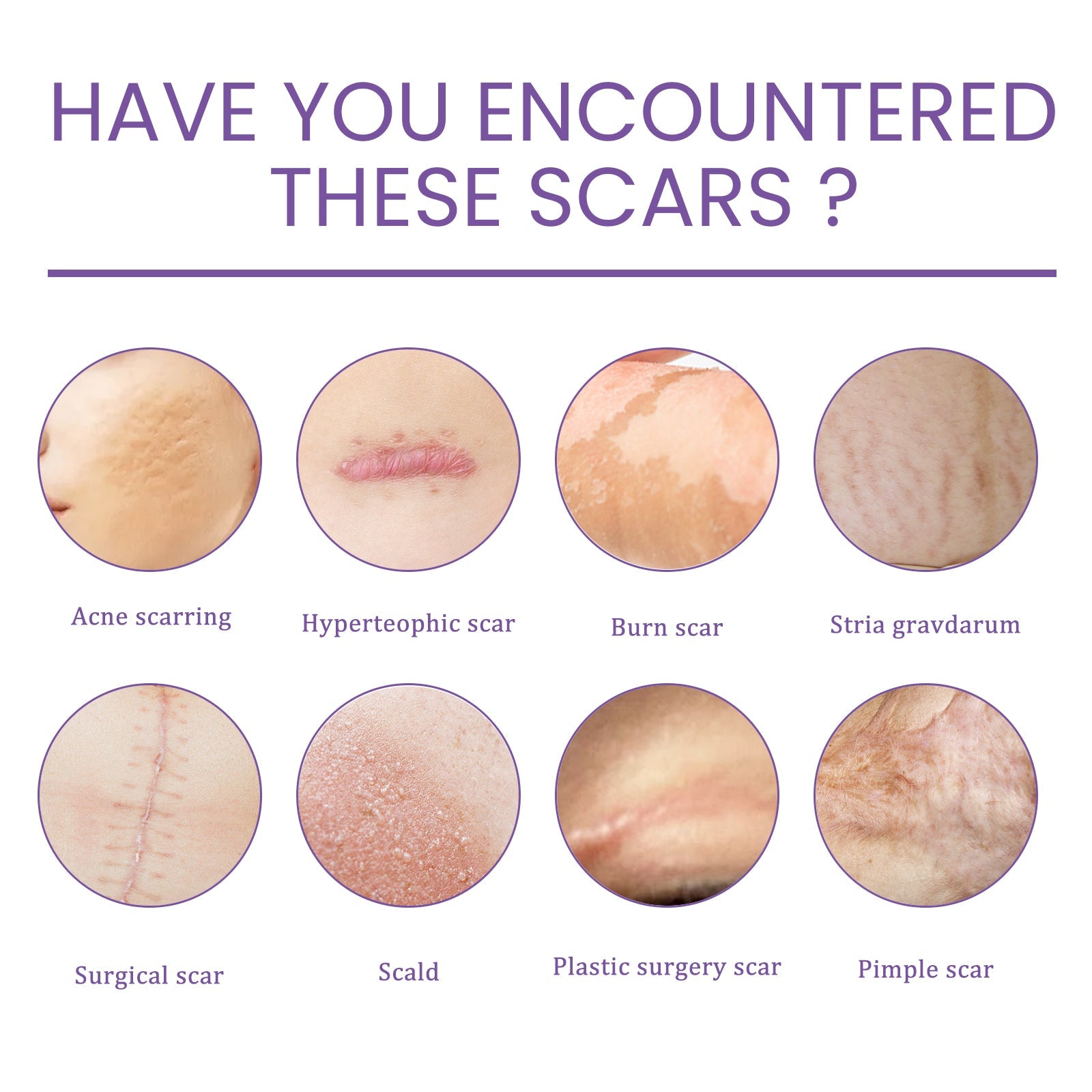 Skin Care Cream, Daily Moisturizing, Smoothing And Firming Skin Repair Postpartum Repair Topical Cream