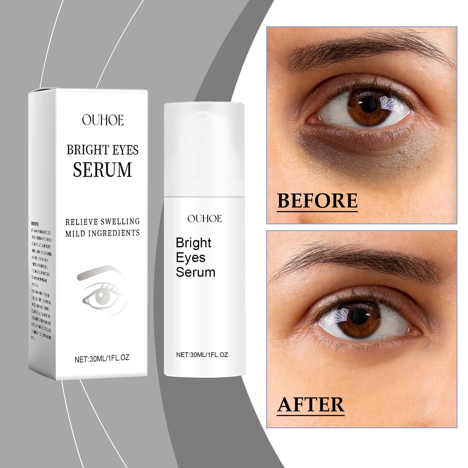 Eye Essence Moisturizes And Tightenes The Skin Around The Eyes, Lightening The Fine Lines And Bags Under The Eyes