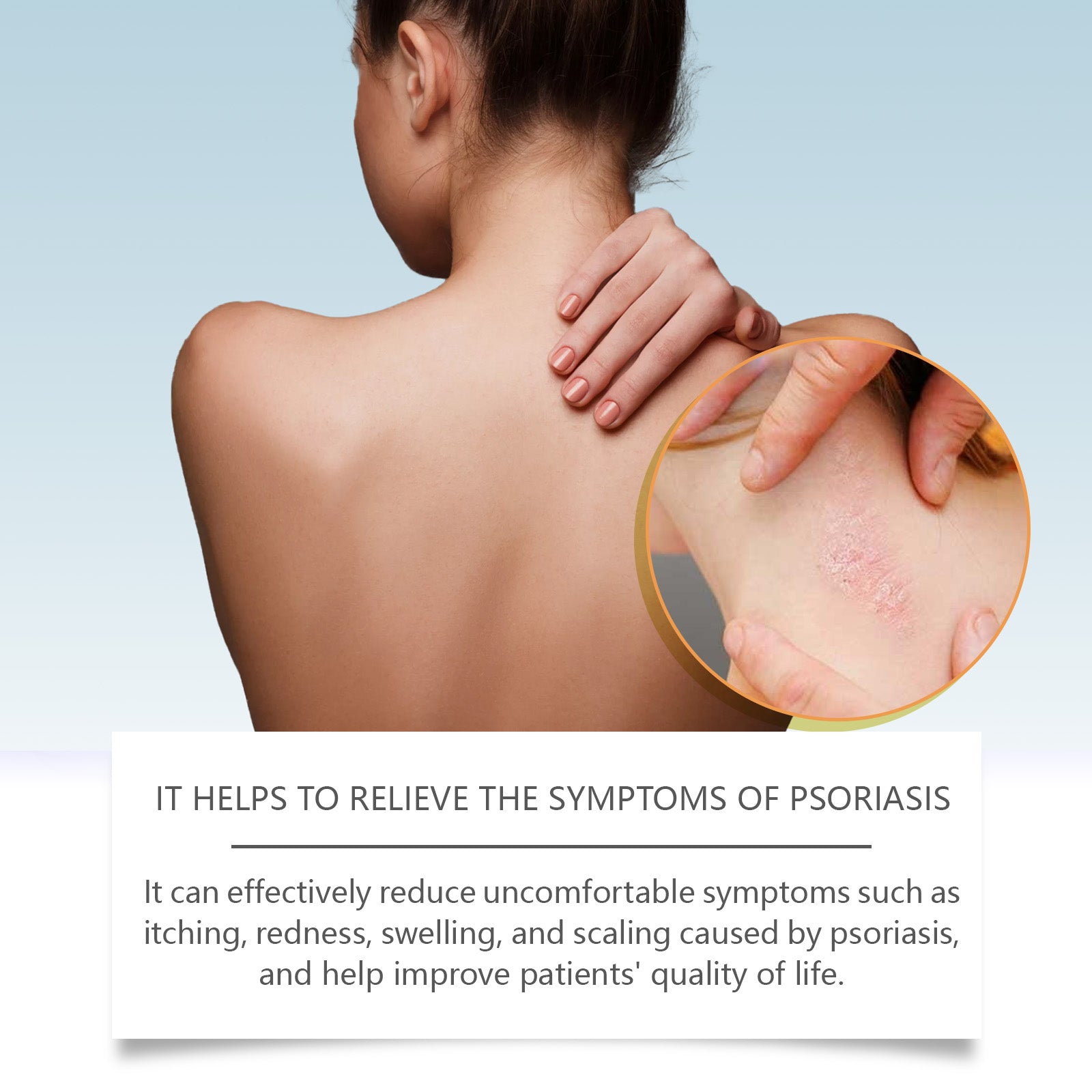 Bee-Venom Cowhide Moss Care Cream Moisturizes And Restores Itchy Red And Swollen Hands And Feet Skin Care Cream