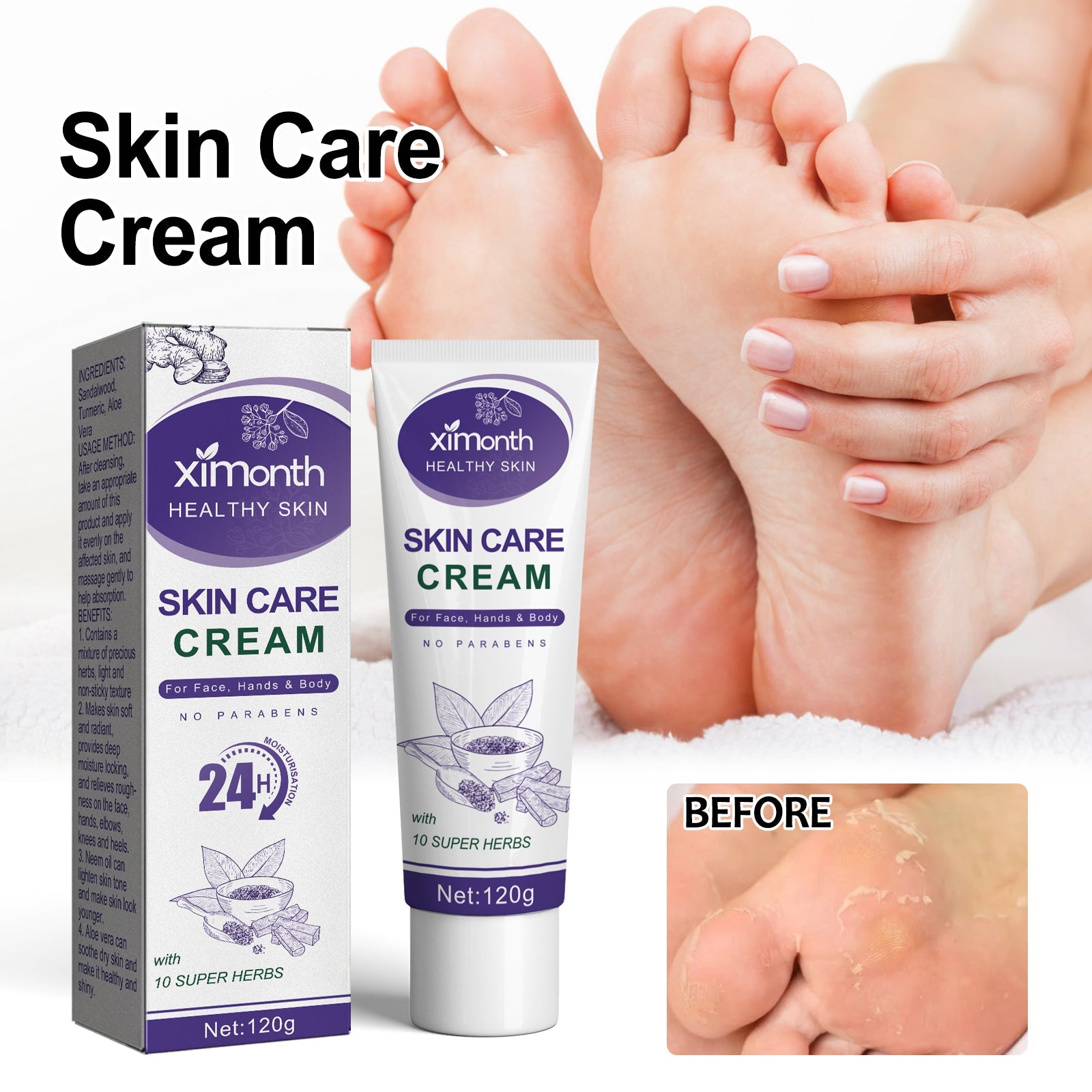 Skin Care Cream, Autumn And Winter Skin Anti-Crack Peeling Exfoliating Moisturizing Soft Moisturizing Body Cream