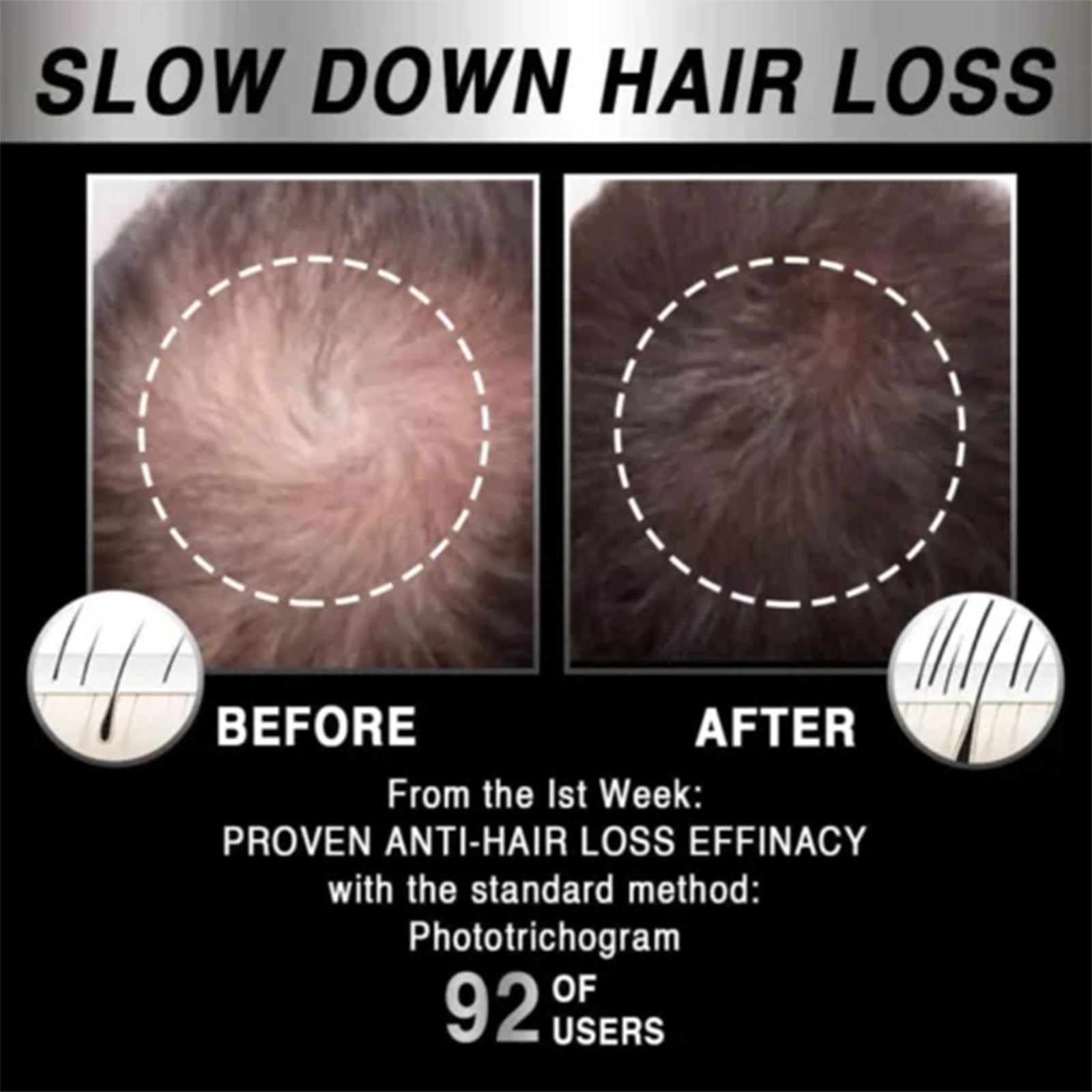 Moving Hair Growth Treatment, Repair Frizzy, Smooth And Dense Hair Scalp Care Heating Massage Cap