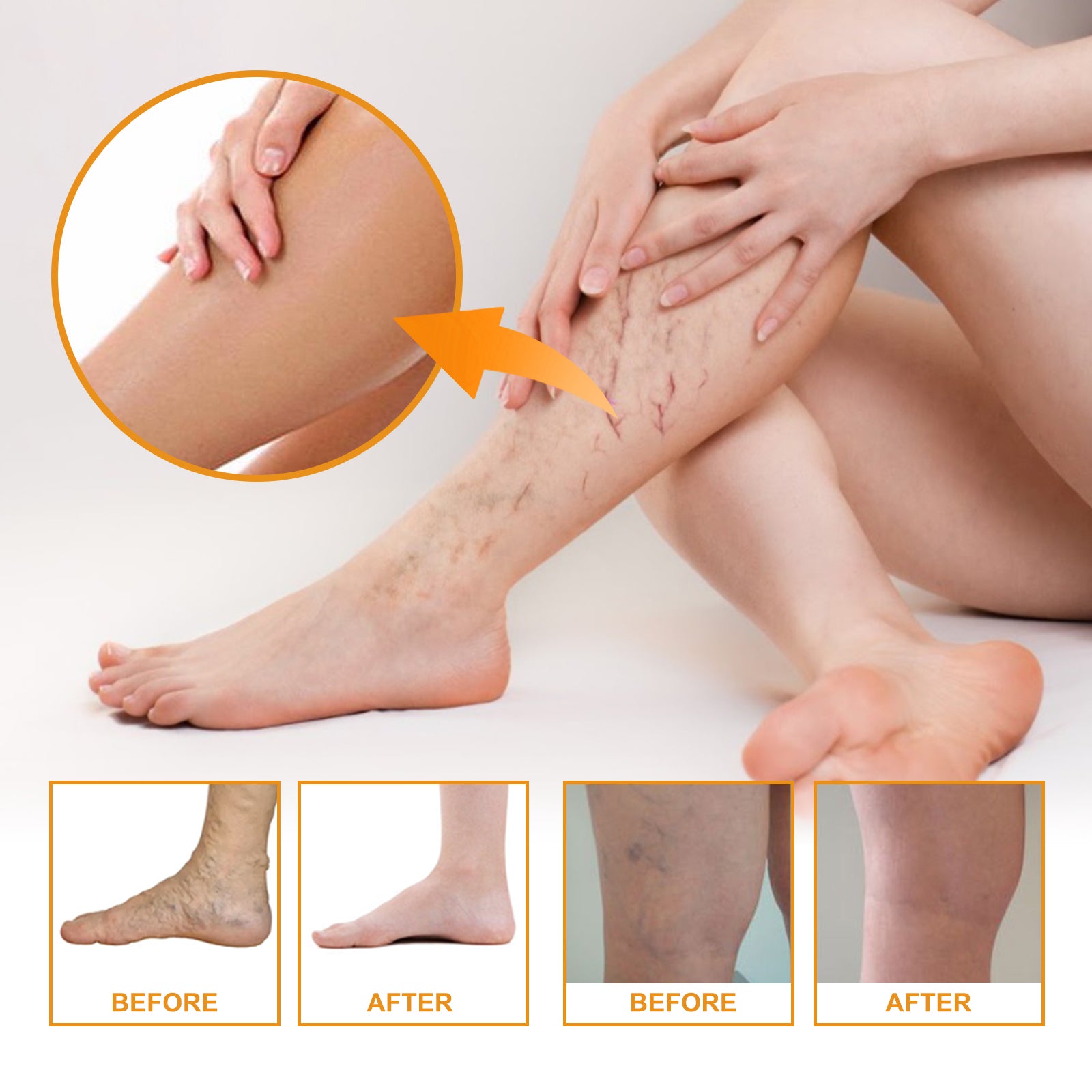 Vitamin K Cream Skin Care For Sore And Swollen Legs Earthworm Leg Vein Massage Cream