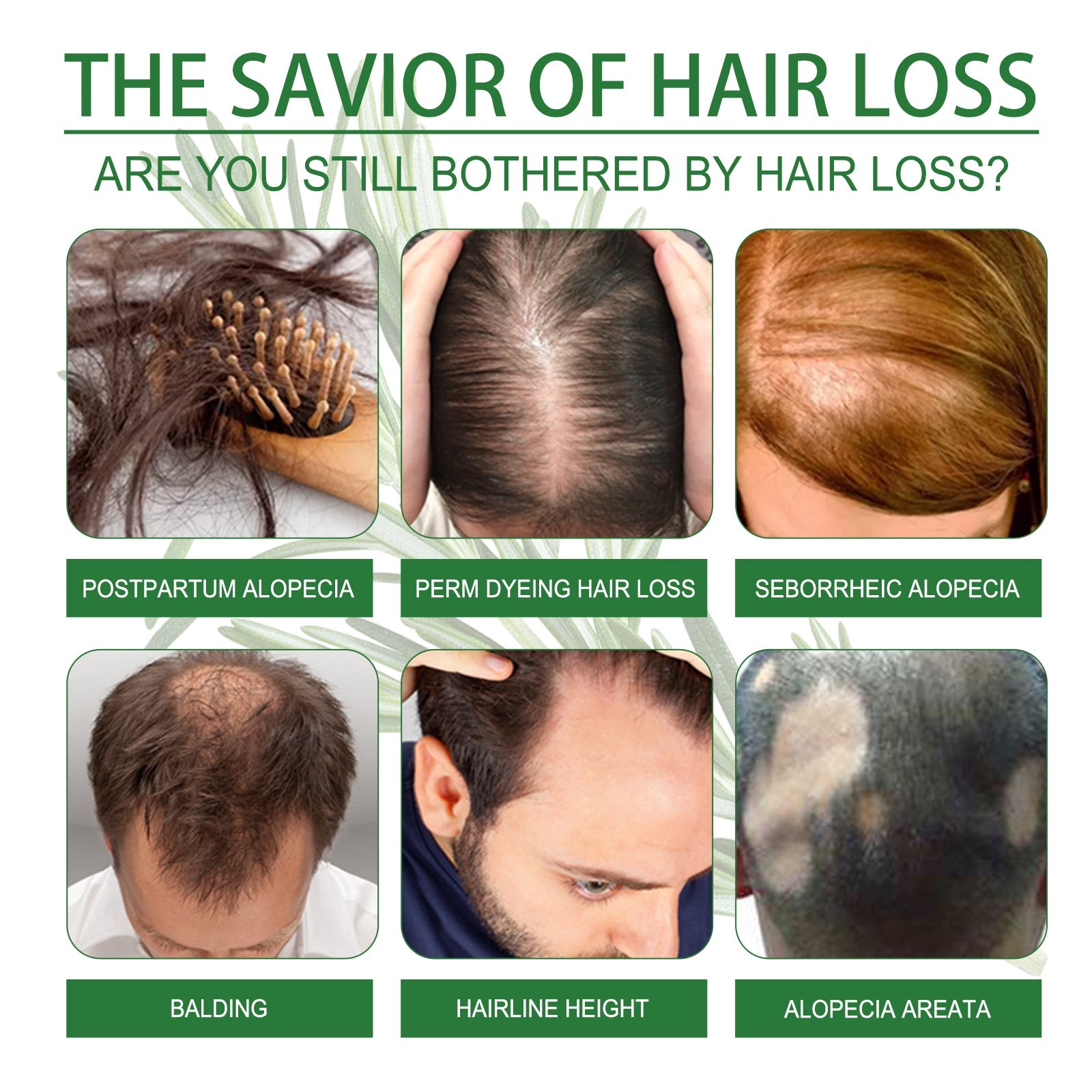 Rosemary Water, Moisturize Hair Roots Repair Damaged Hair Strengthen Hair And Prevent Hair Loss