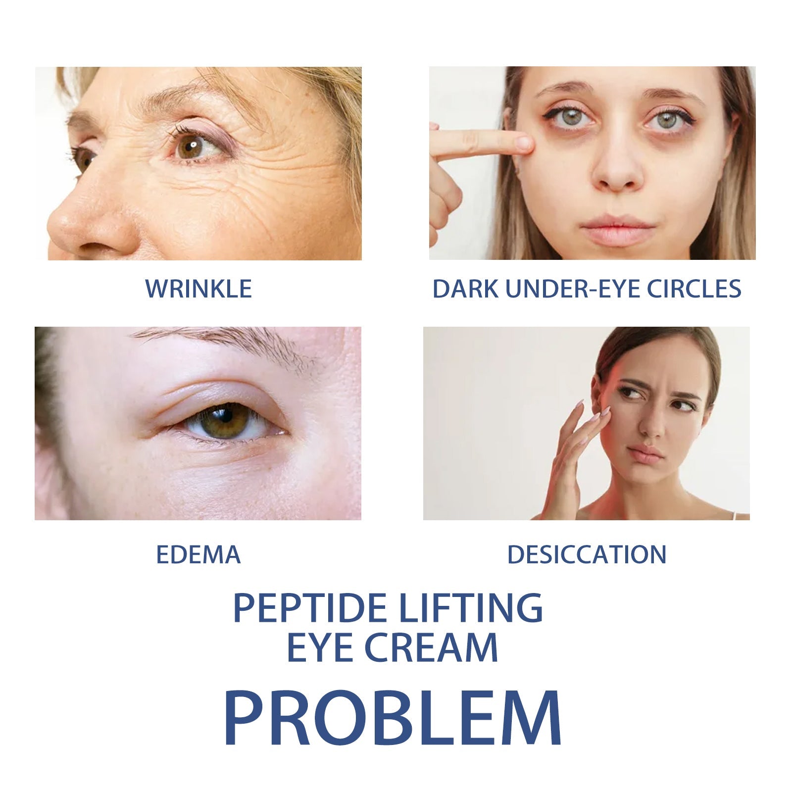 Peptide Lifting Eye Cream, Moisturize The Skin Around The Eyes, Improve The Eyes And Fade Fine Lines
