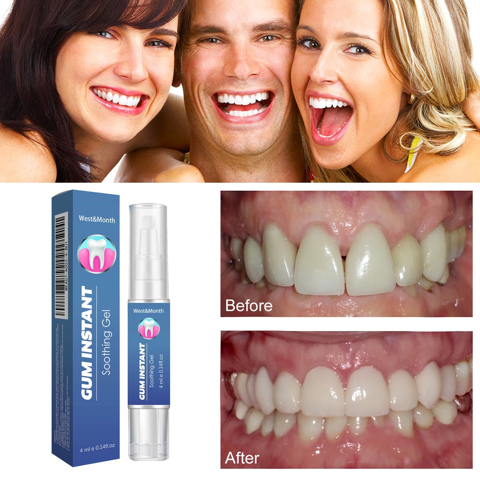 WestMonth Gum Instant Soothing Gel, Relieve Gums Swelling And Pain Clean Teeth Plaque Stains And Whiten Teeth Gel