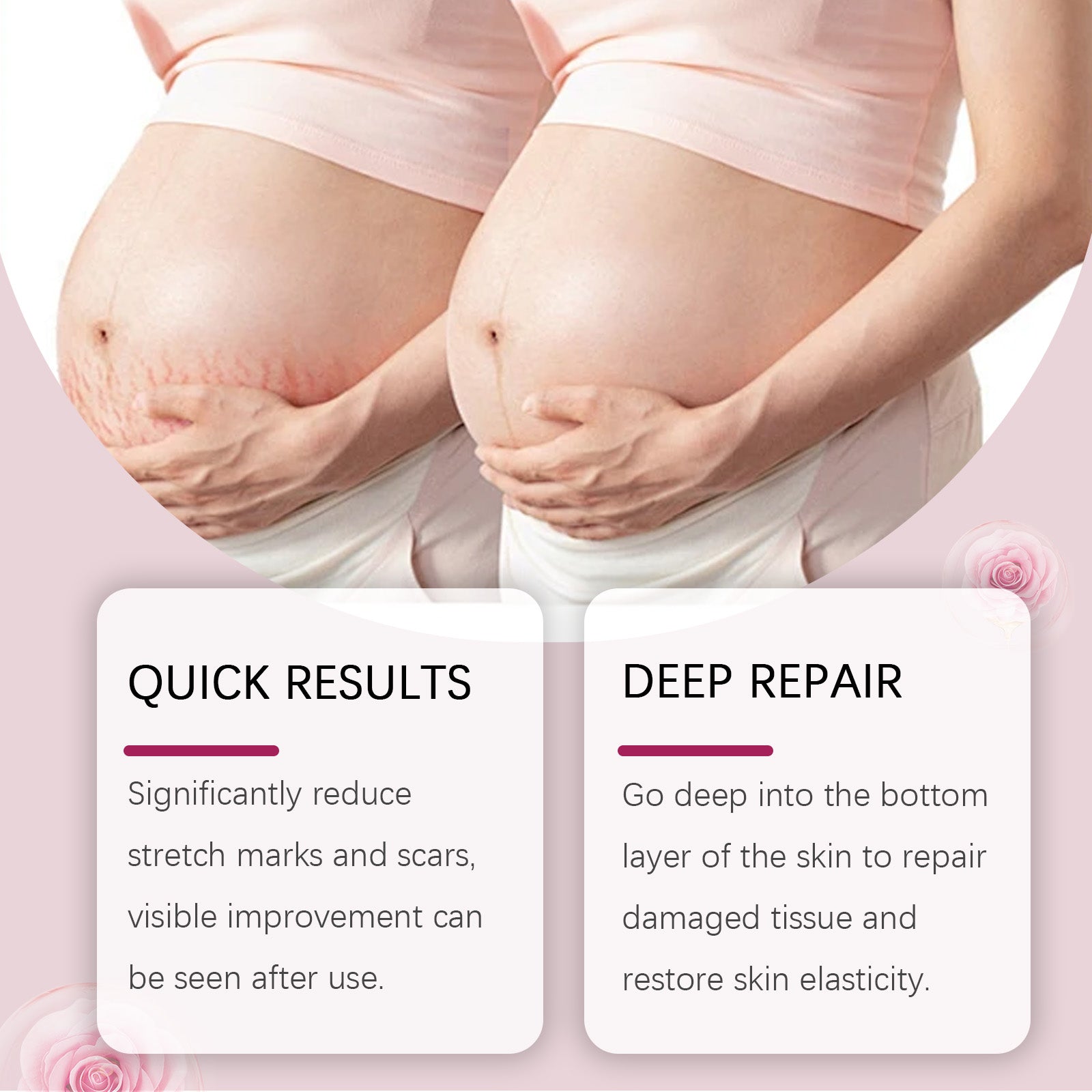 Skin Care Oil Moisturizes Postpartum Skin Fine Lines And Enhances Elasticity With A Moisturizing Cream For The Body